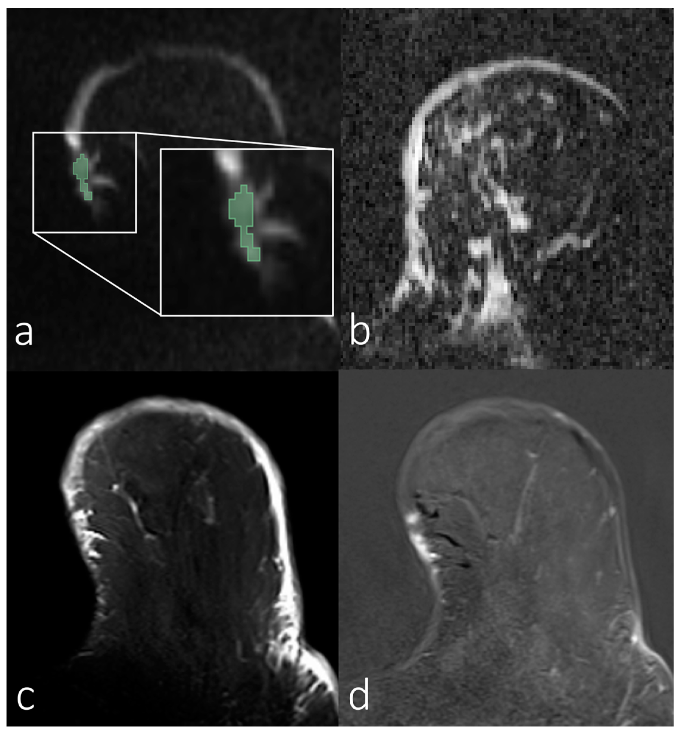 Diagnostics 14 00934 g003