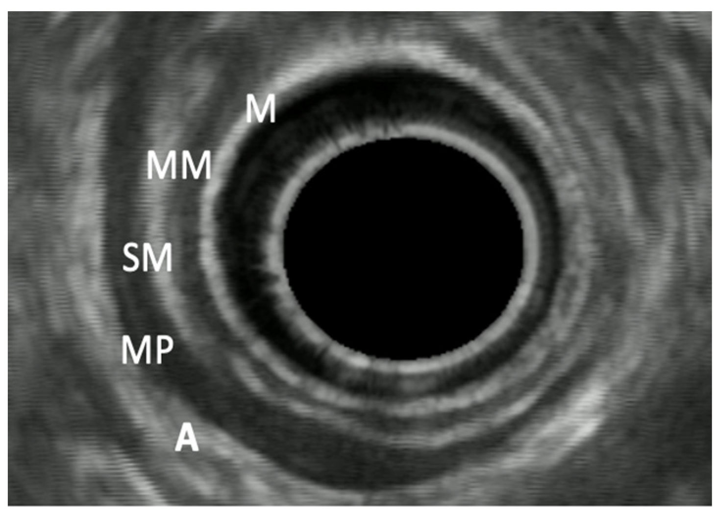 Diagnostics 14 00996 g001 Diagnostics 14 00996 g001