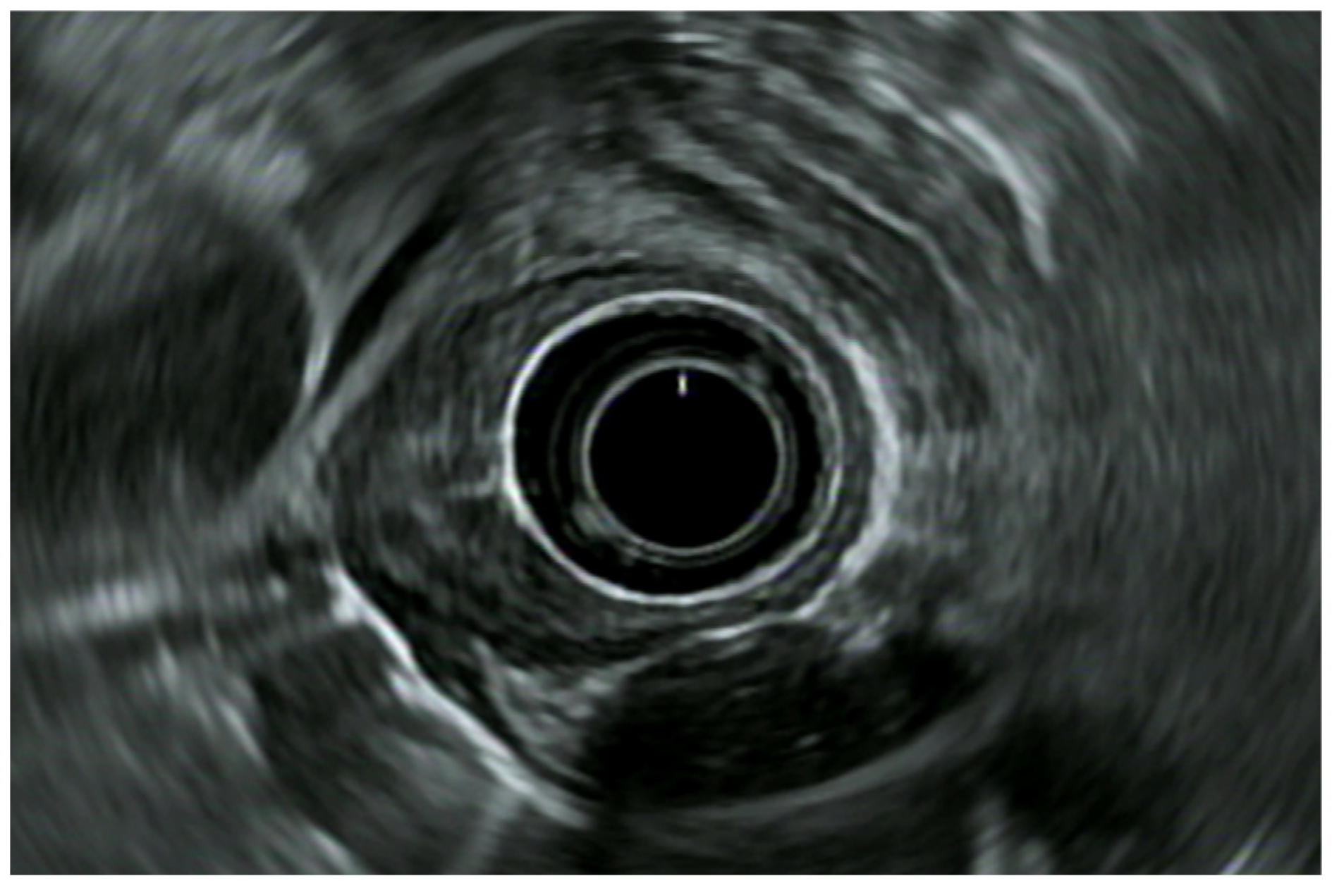 Diagnostics 14 00996 g002 Diagnostics 14 00996 g002