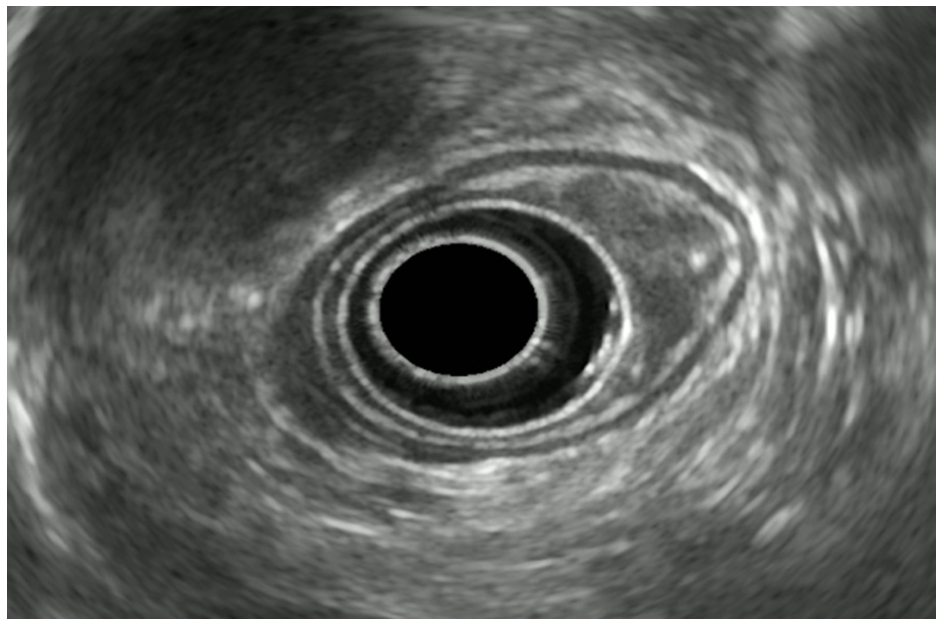 Diagnostics 14 00996 g004 Diagnostics 14 00996 g004