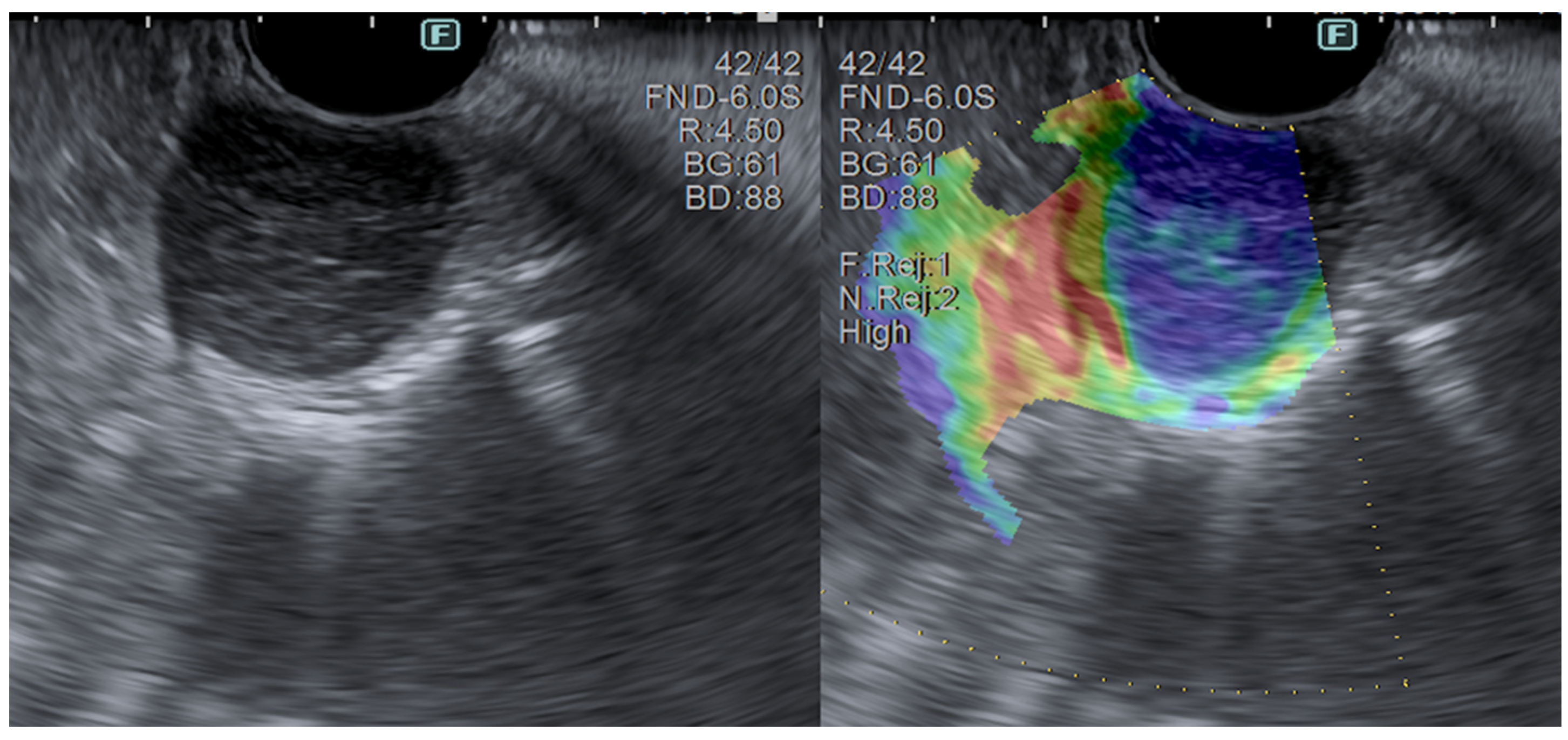 Diagnostics 14 00996 g007 Diagnostics 14 00996 g007