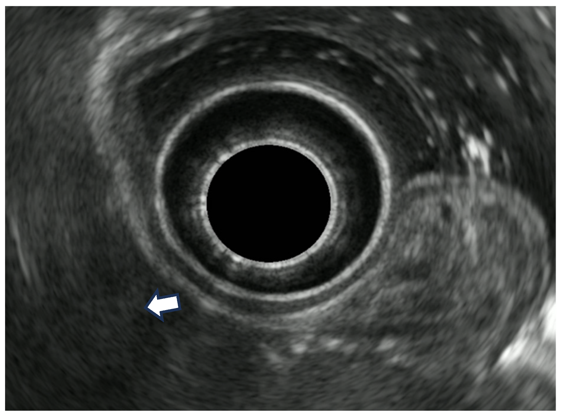 Diagnostics 14 00996 g008 Diagnostics 14 00996 g008
