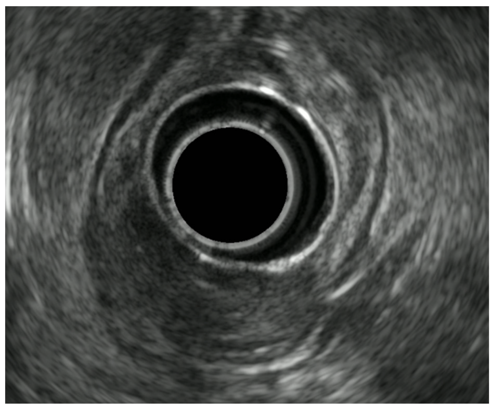 Diagnostics 14 00996 g009 Diagnostics 14 00996 g009