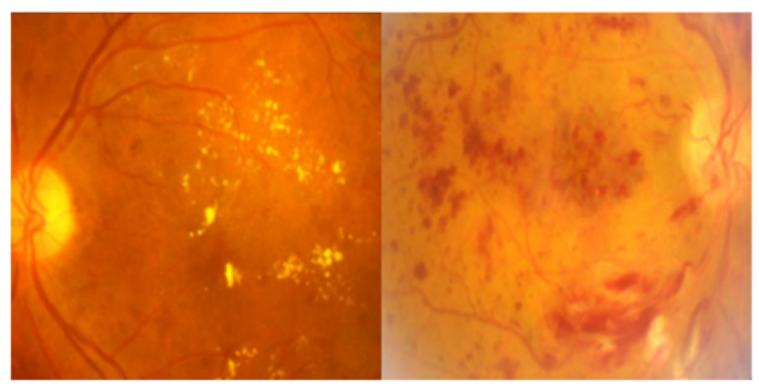 Diagnostics 14 01093 g002