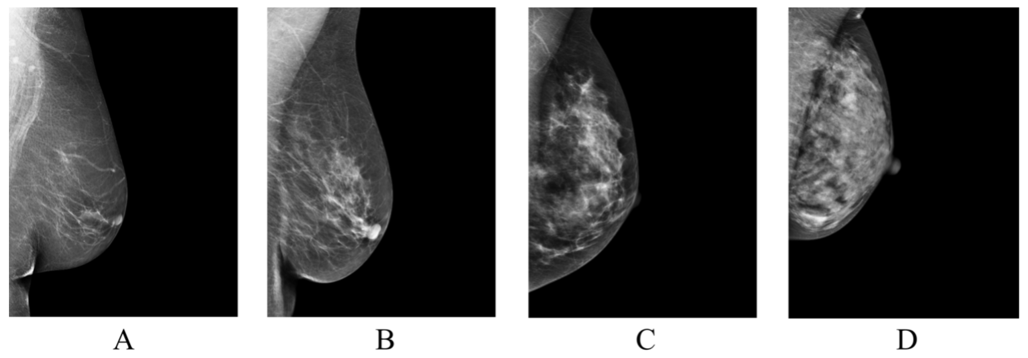 Diagnostics | Free Full-Text | Enhancing Accuracy in Breast Density  Assessment Using Deep Learning: A Multicentric, Multi-Reader Study