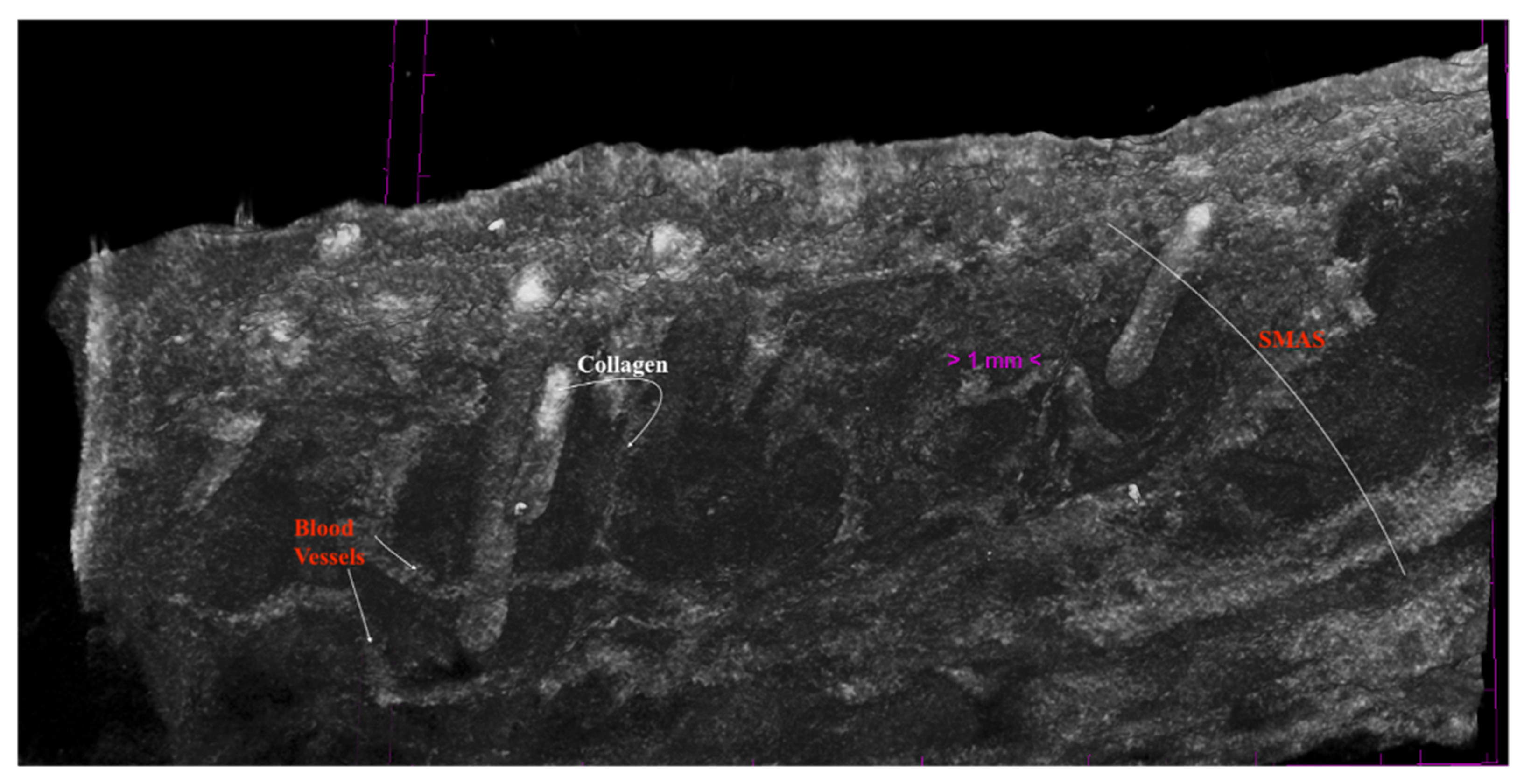 Diagnostics 14 01126 g010