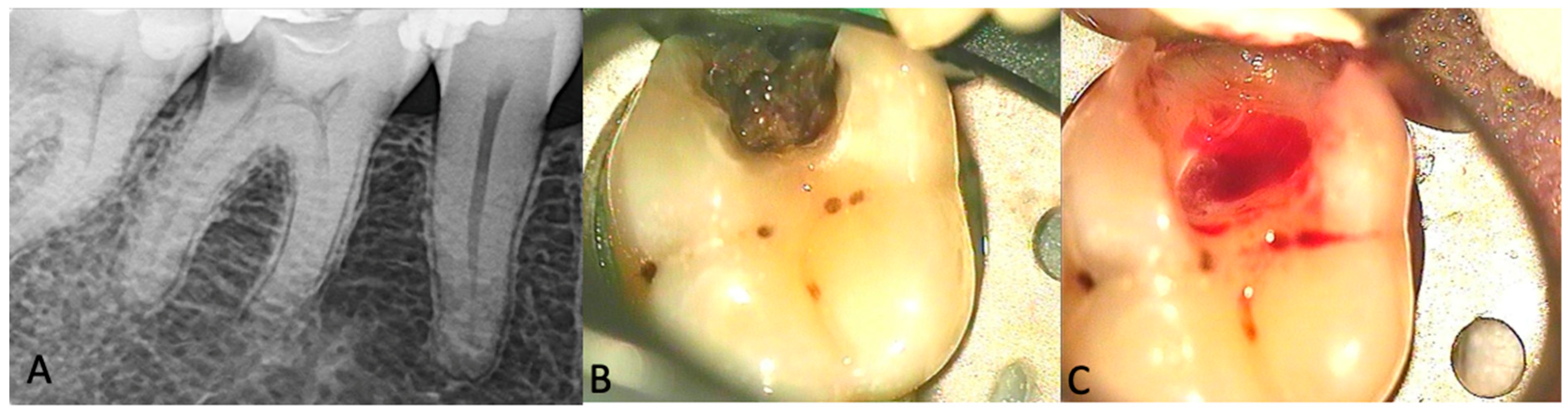 Diagnostics 14 01128 g001