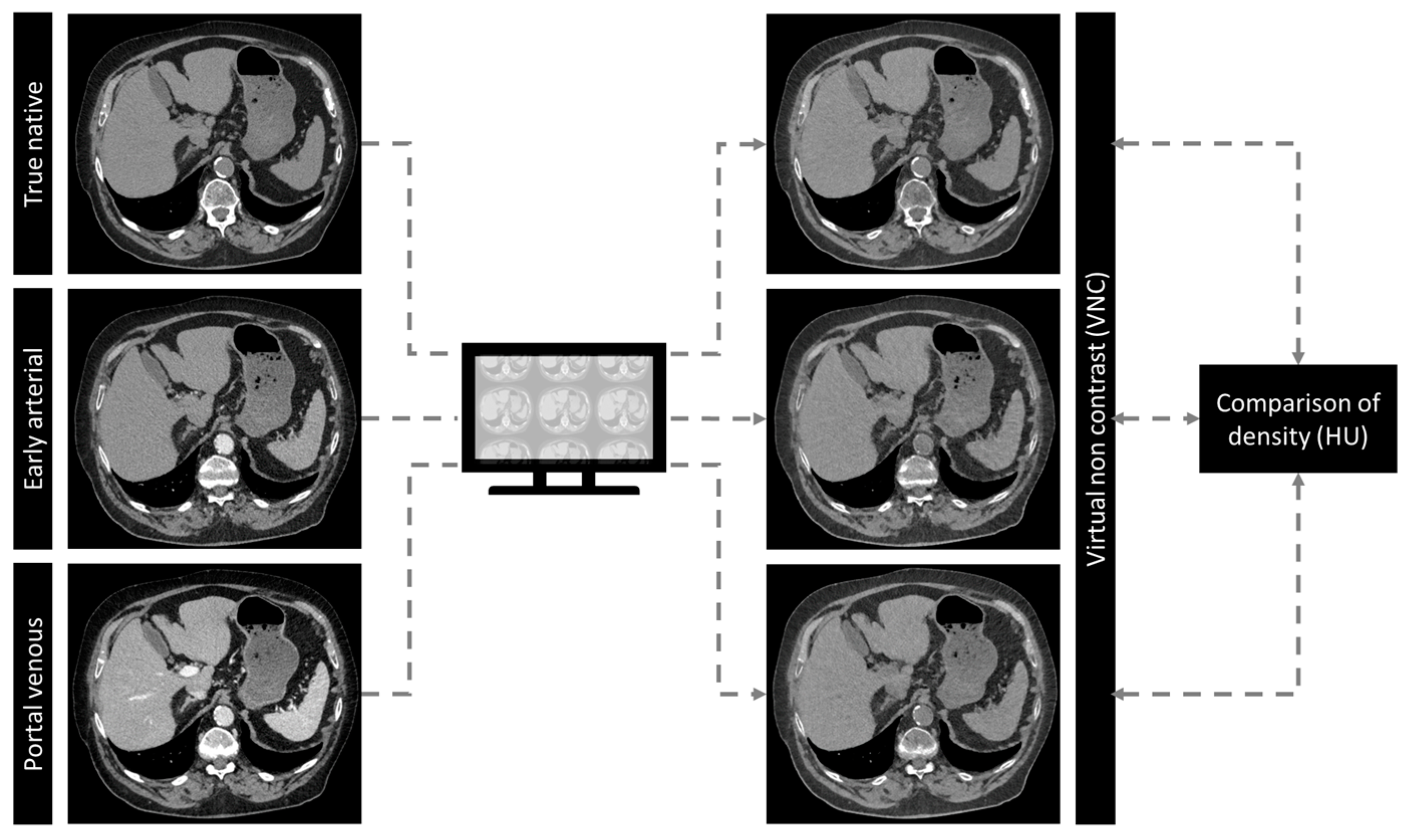 Diagnostics 14 01130 g001