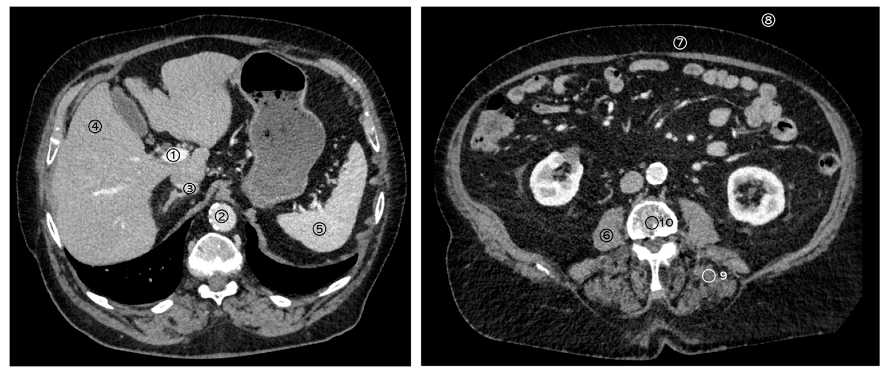 Diagnostics 14 01130 g002