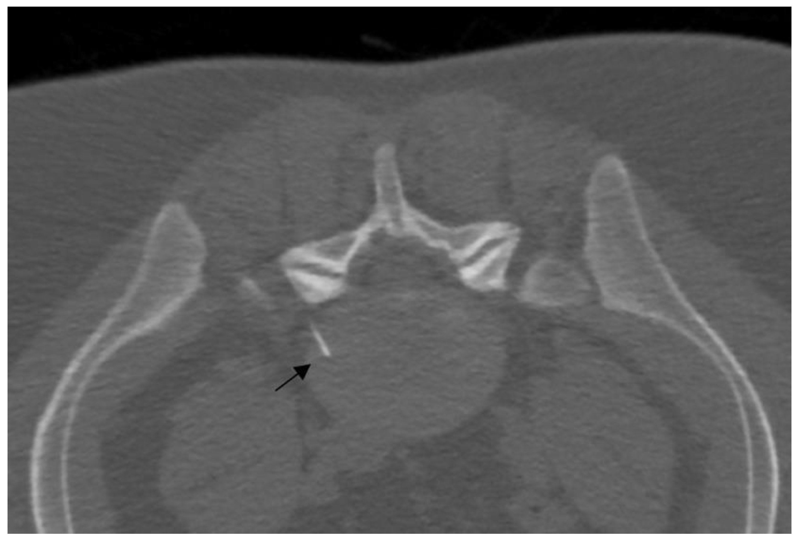 Diagnostics 14 01147 g003