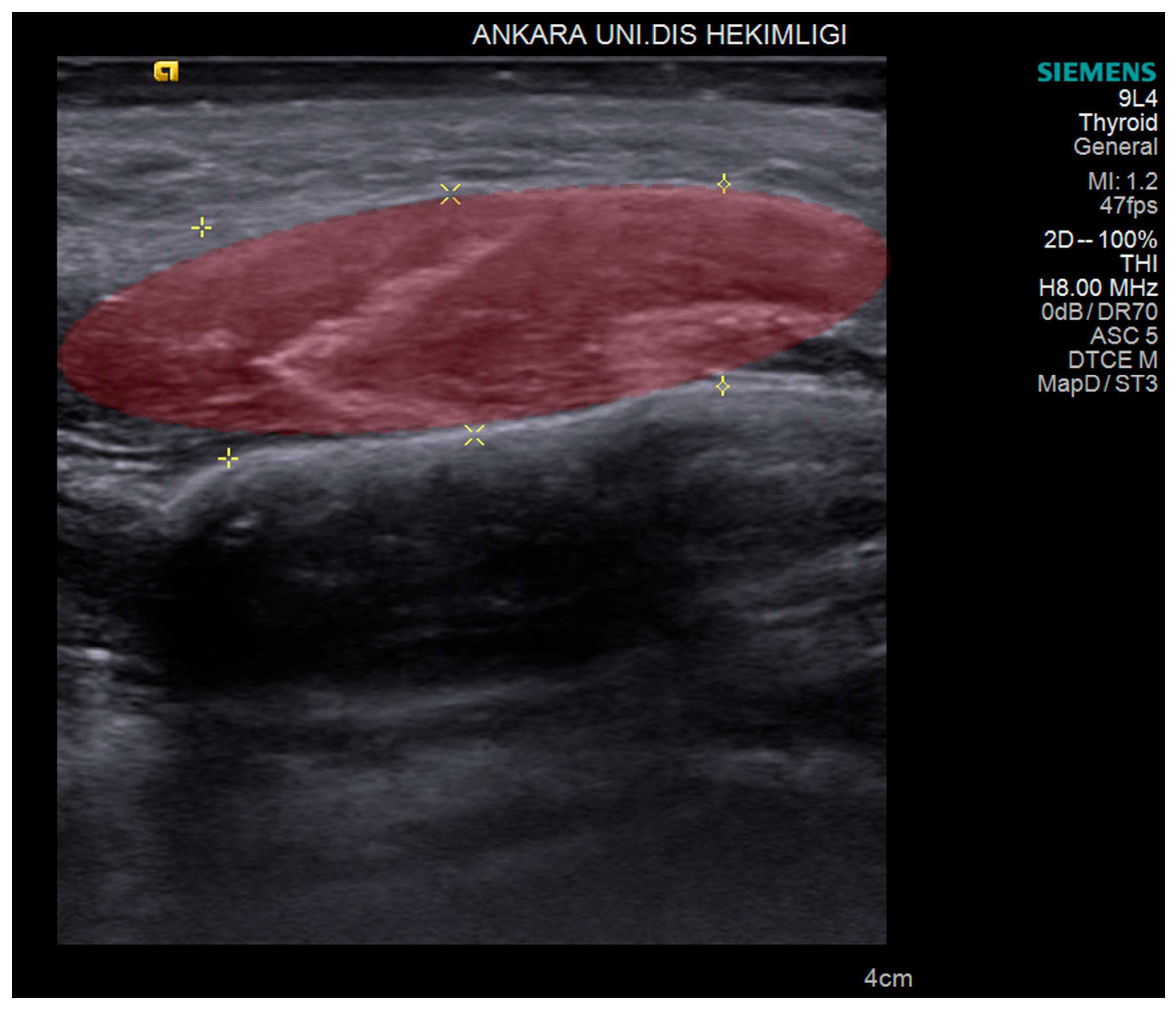 Diagnostics 14 01158 g001