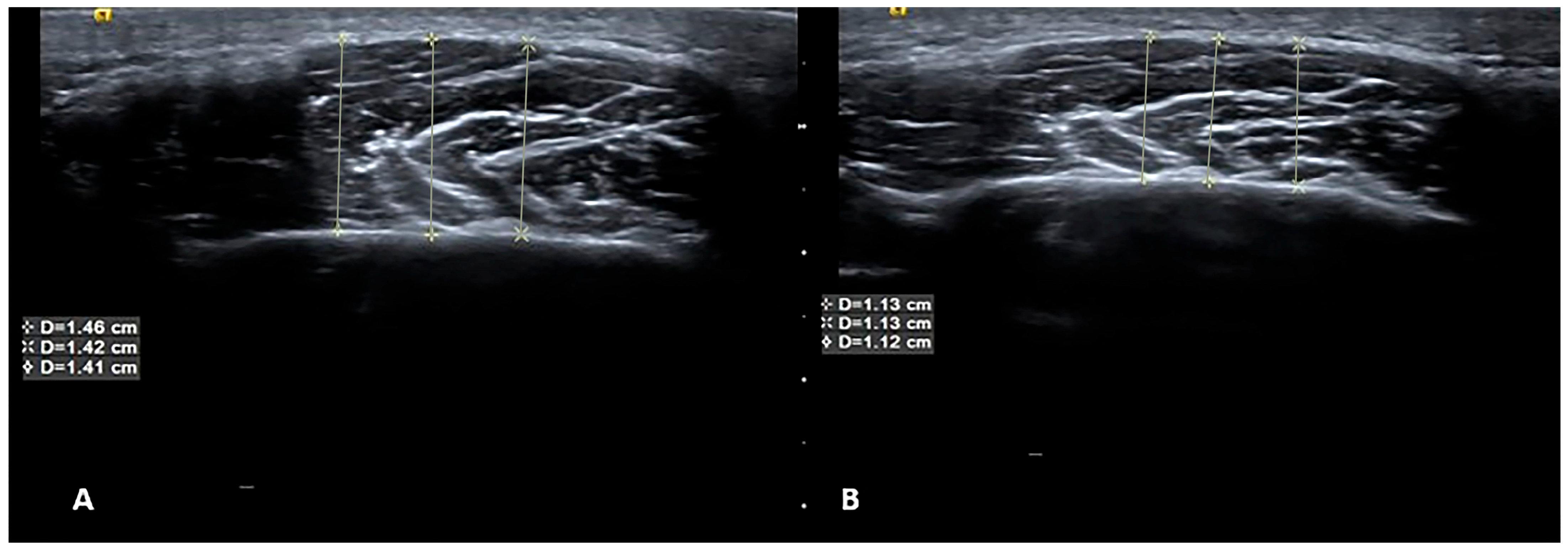 Diagnostics 14 01158 g002