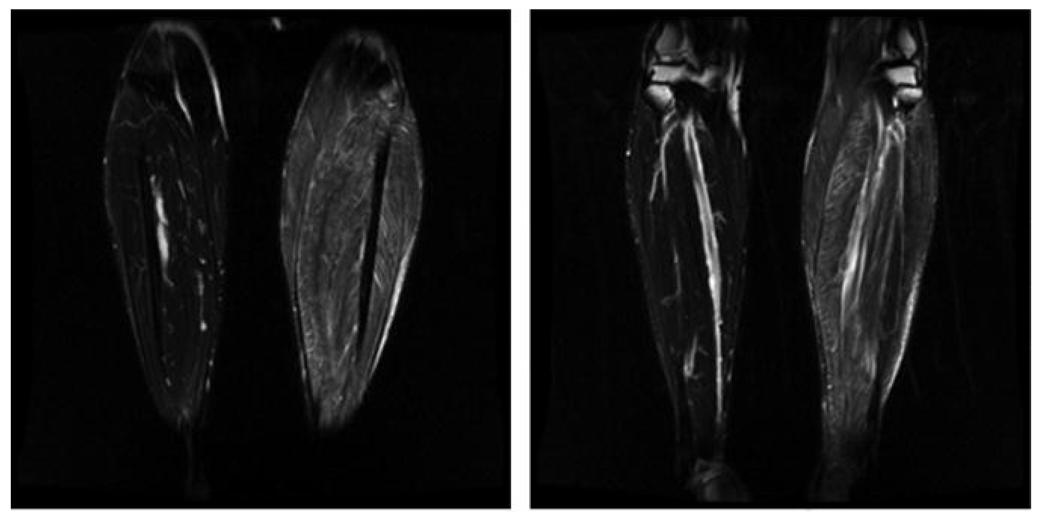 Diagnostics 14 01169 g003 Diagnostics 14 01169 g003