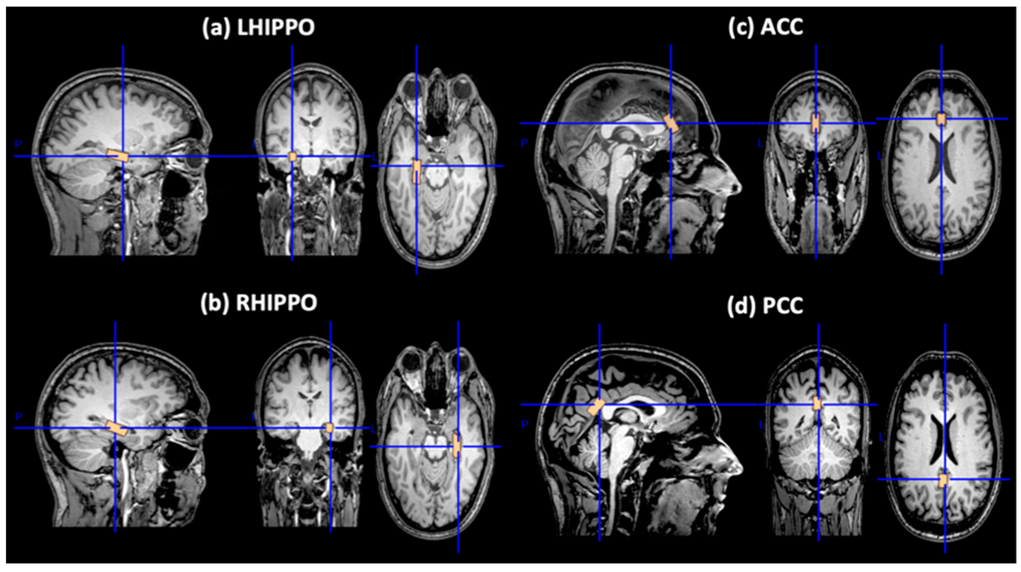 Diagnostics 14 01170 g001