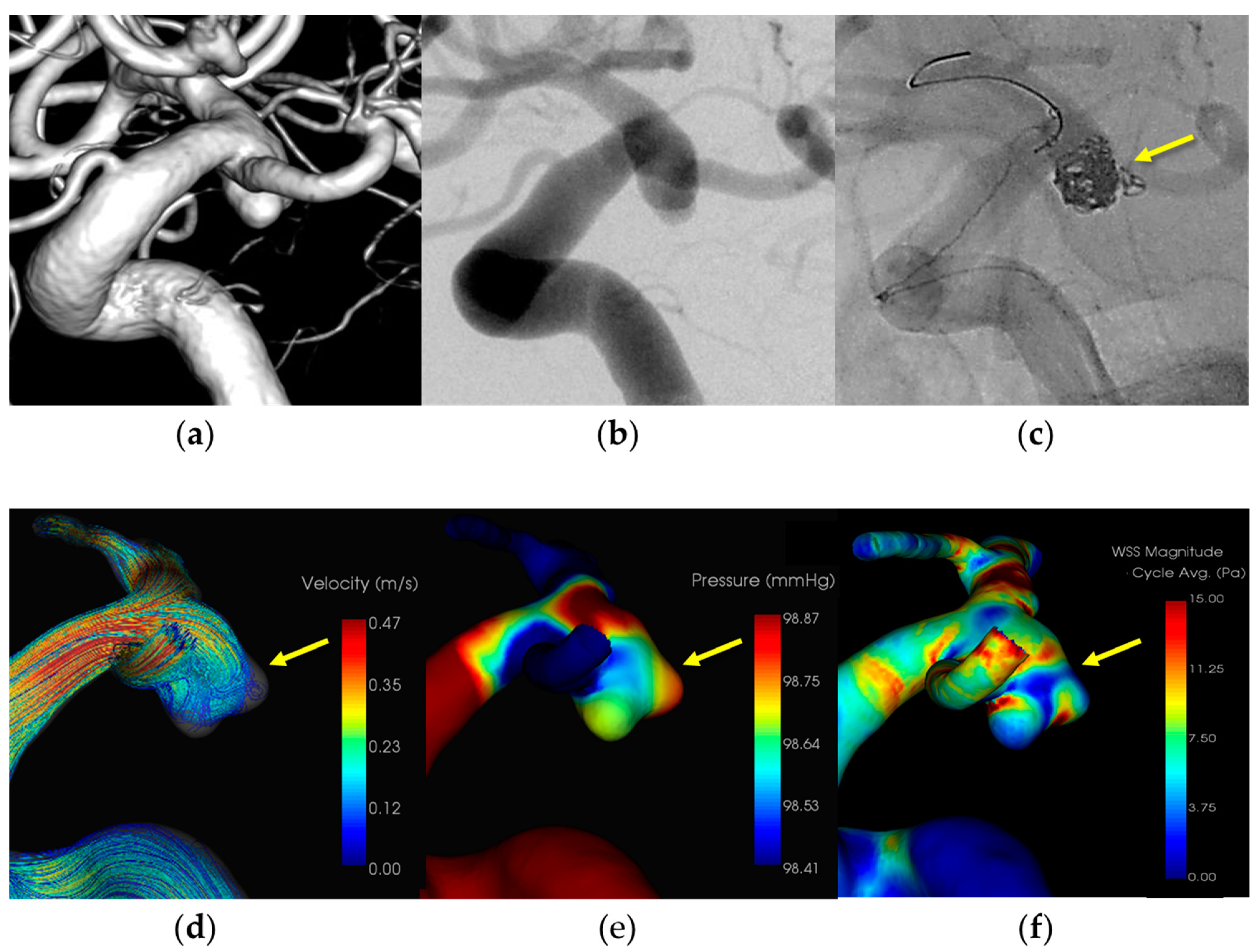 Diagnostics 14 01203 g004