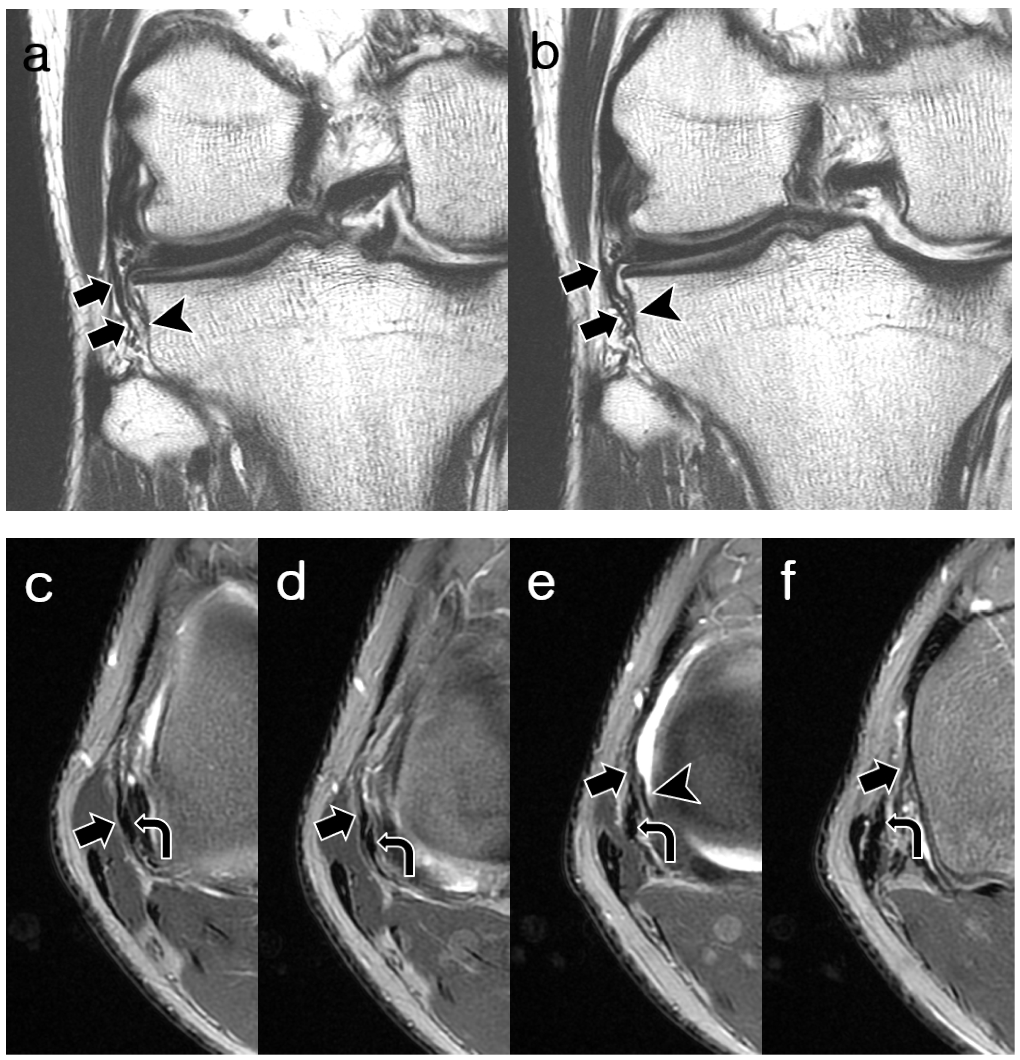 Diagnostics 14 01226 g004