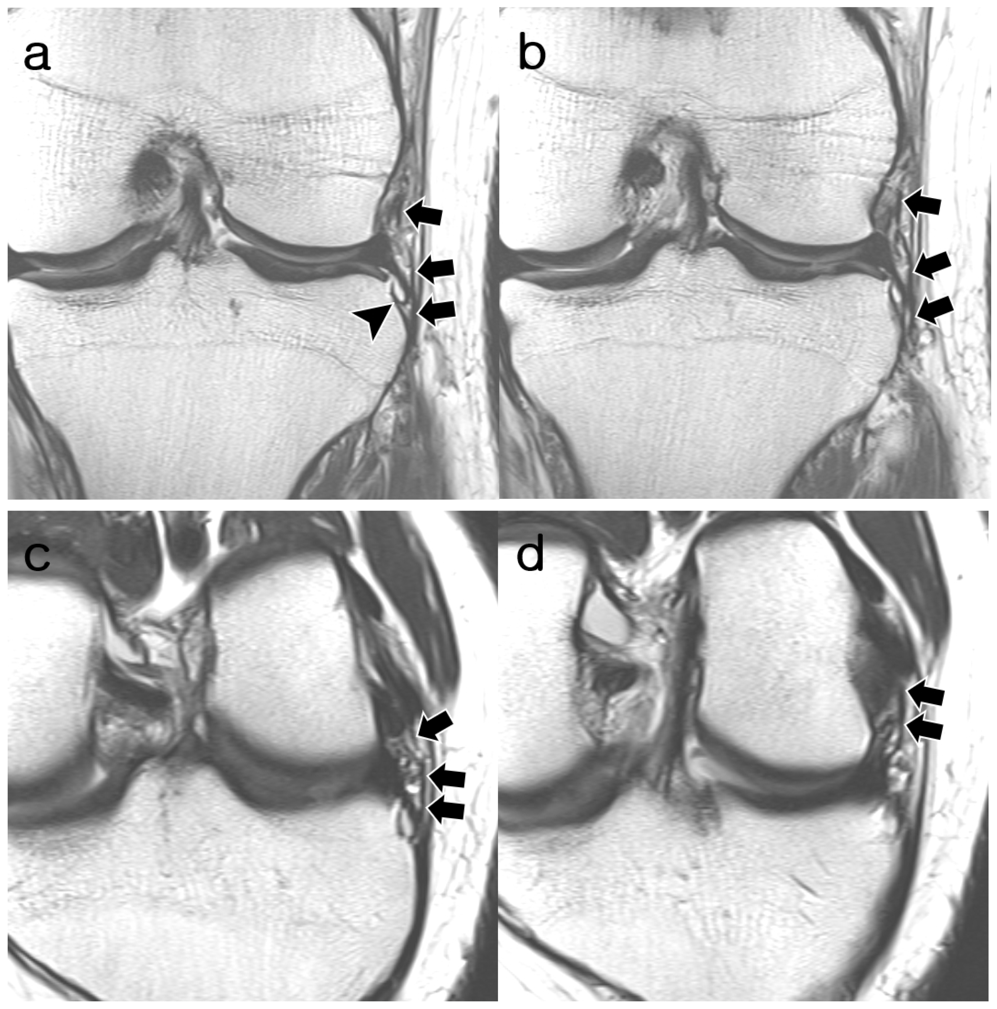 Diagnostics 14 01226 g006