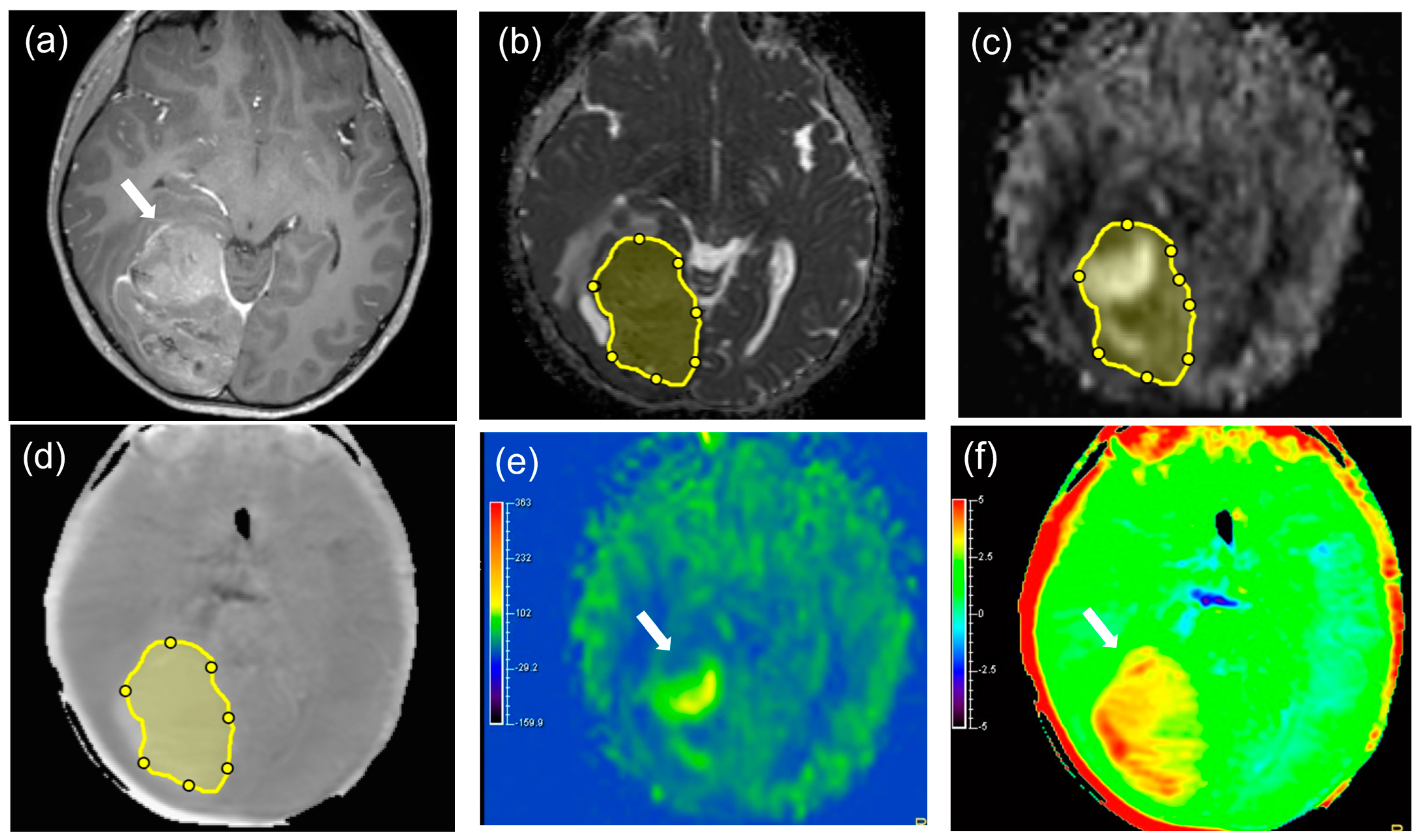 Diagnostics 14 01236 g004a