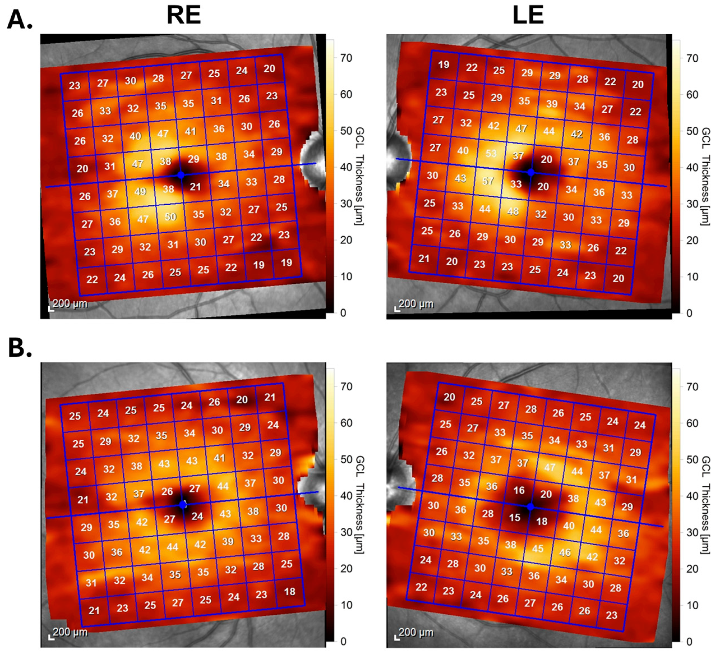 Diagnostics 14 01255 g001
