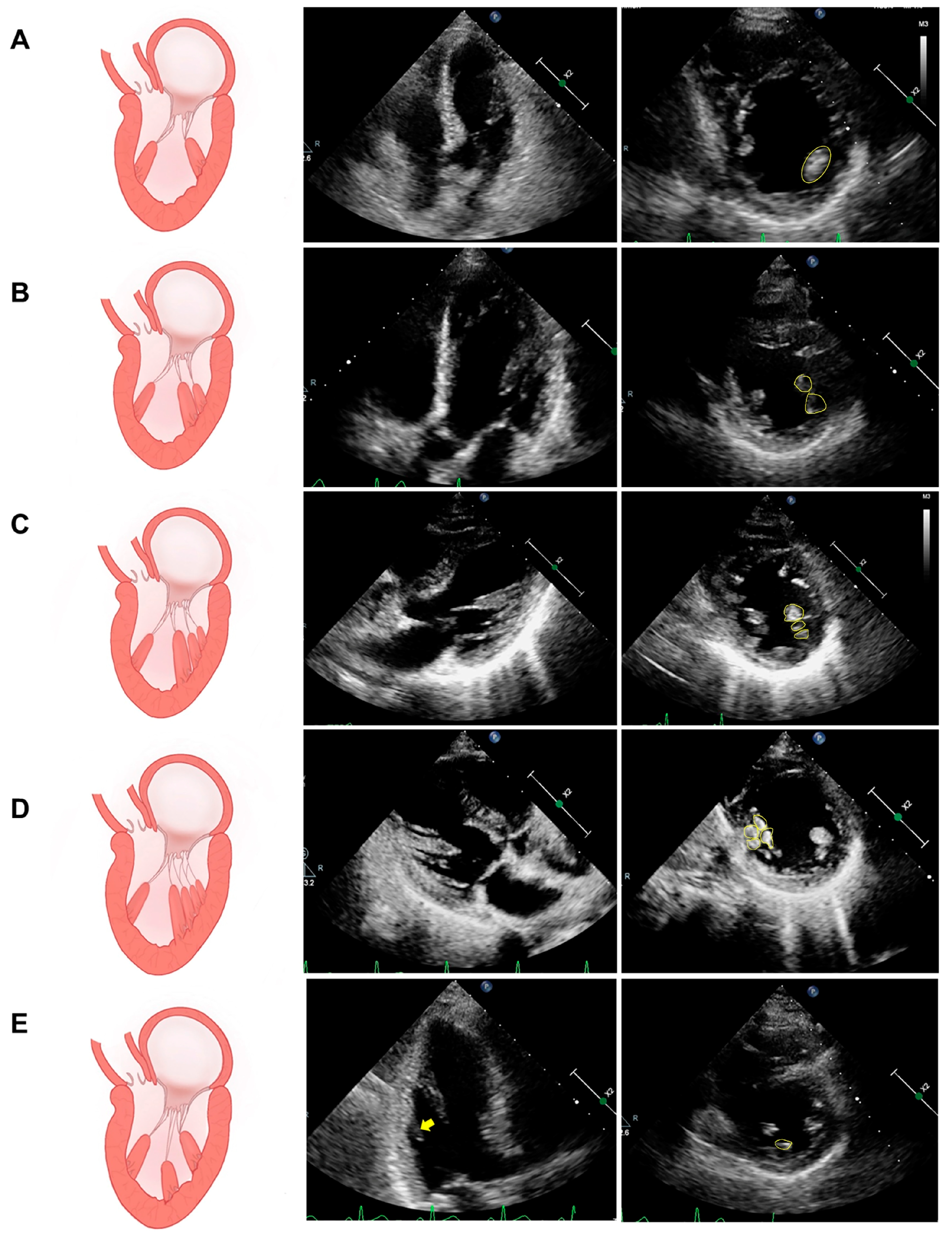 Diagnostics 14 01270 g001