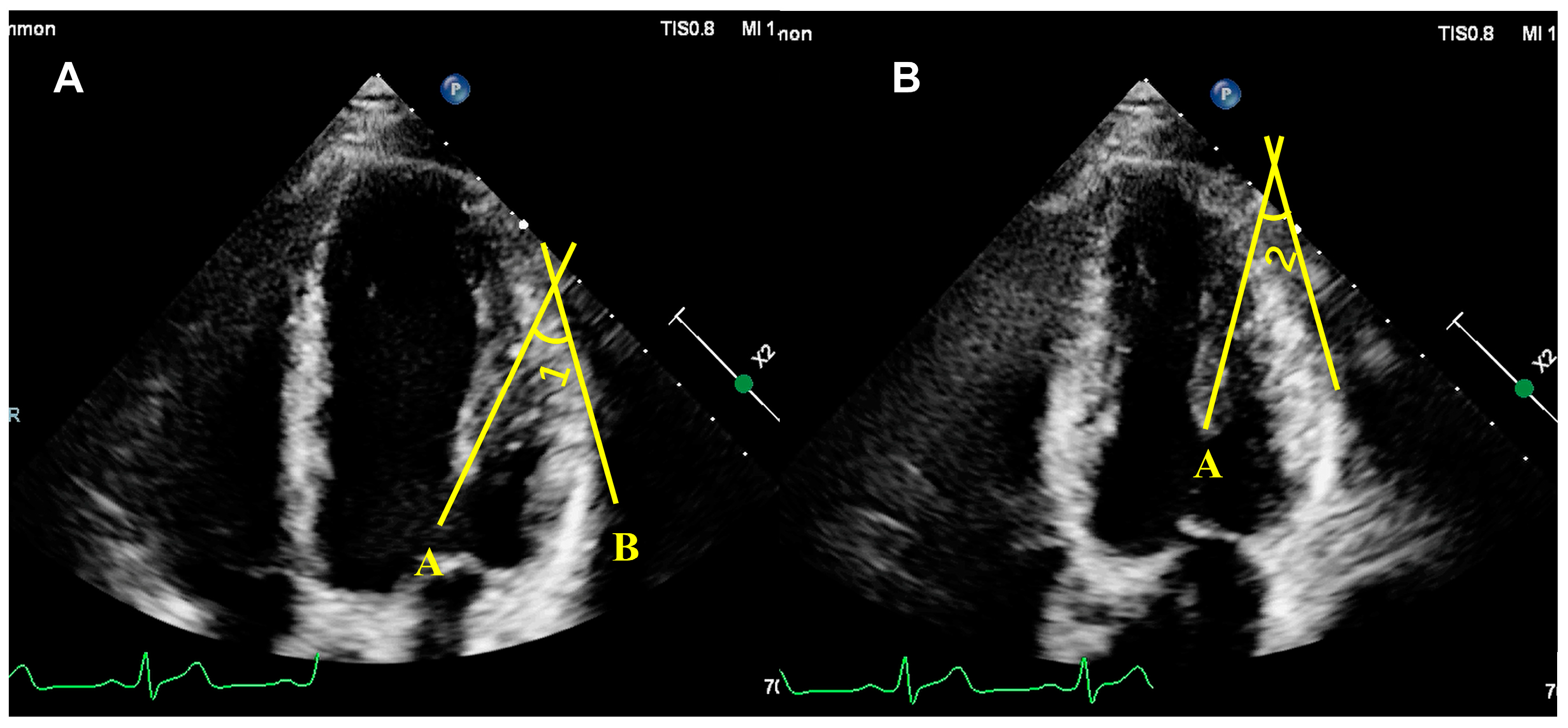 Diagnostics 14 01270 g004