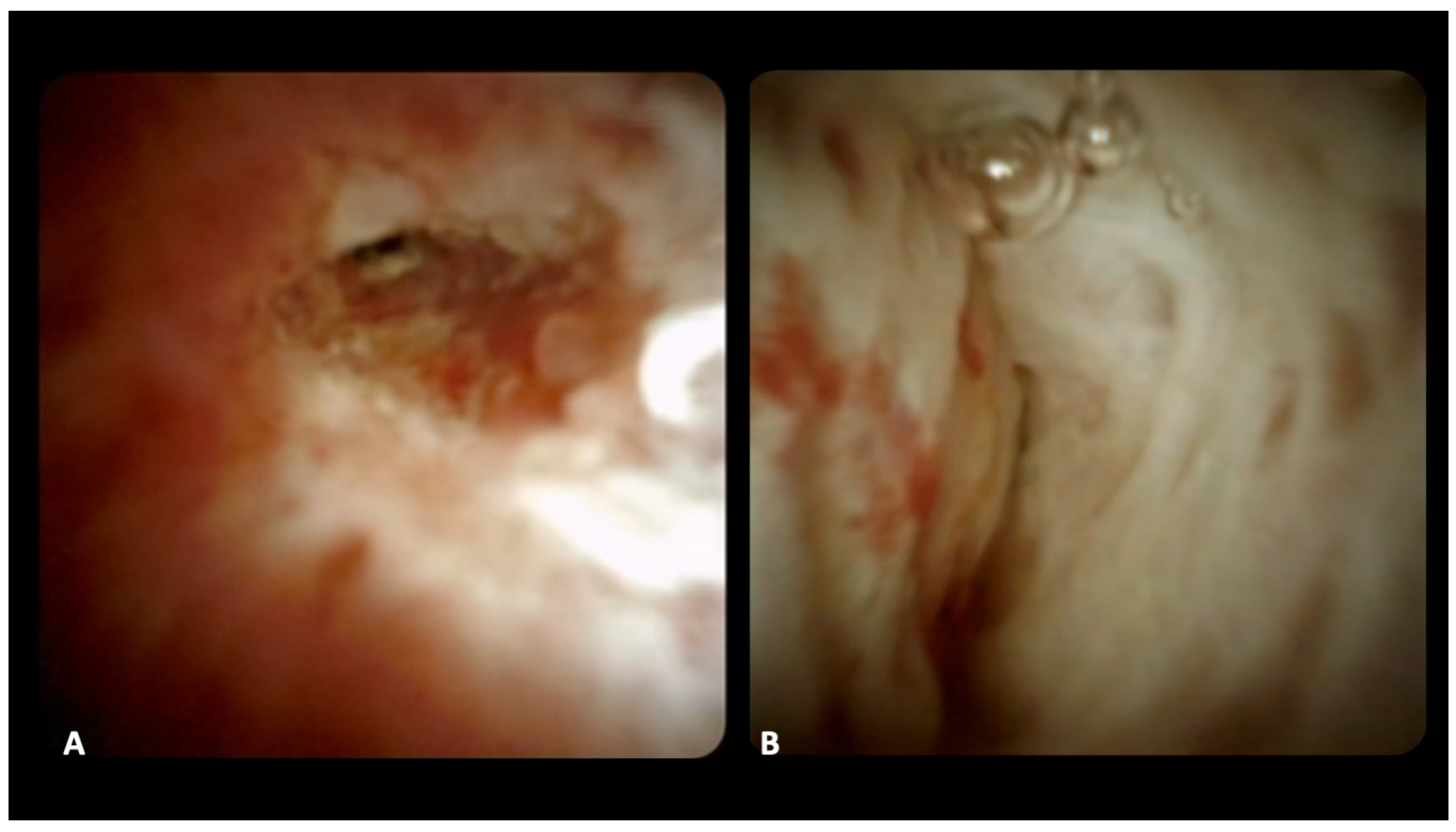 Diagnostics 14 01316 g001 Diagnostics 14 01316 g001