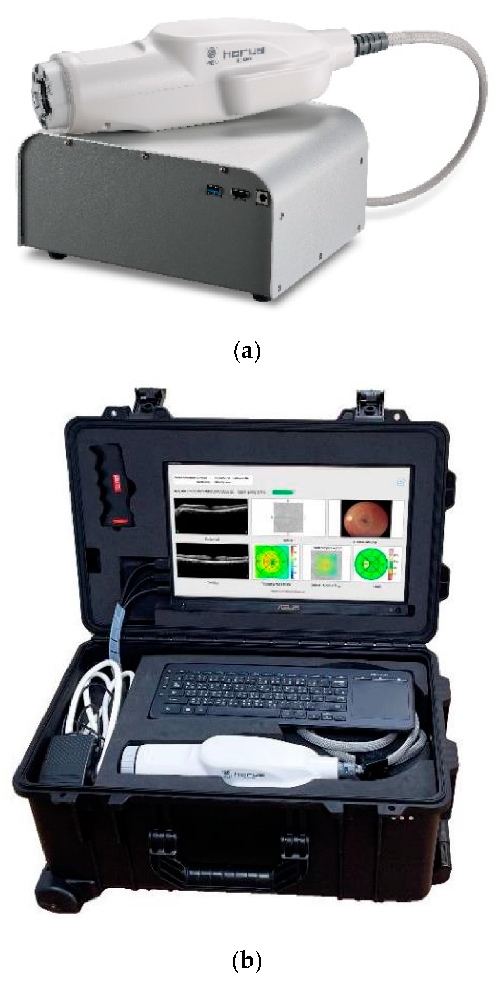 Diagnostics 14 01320 g001