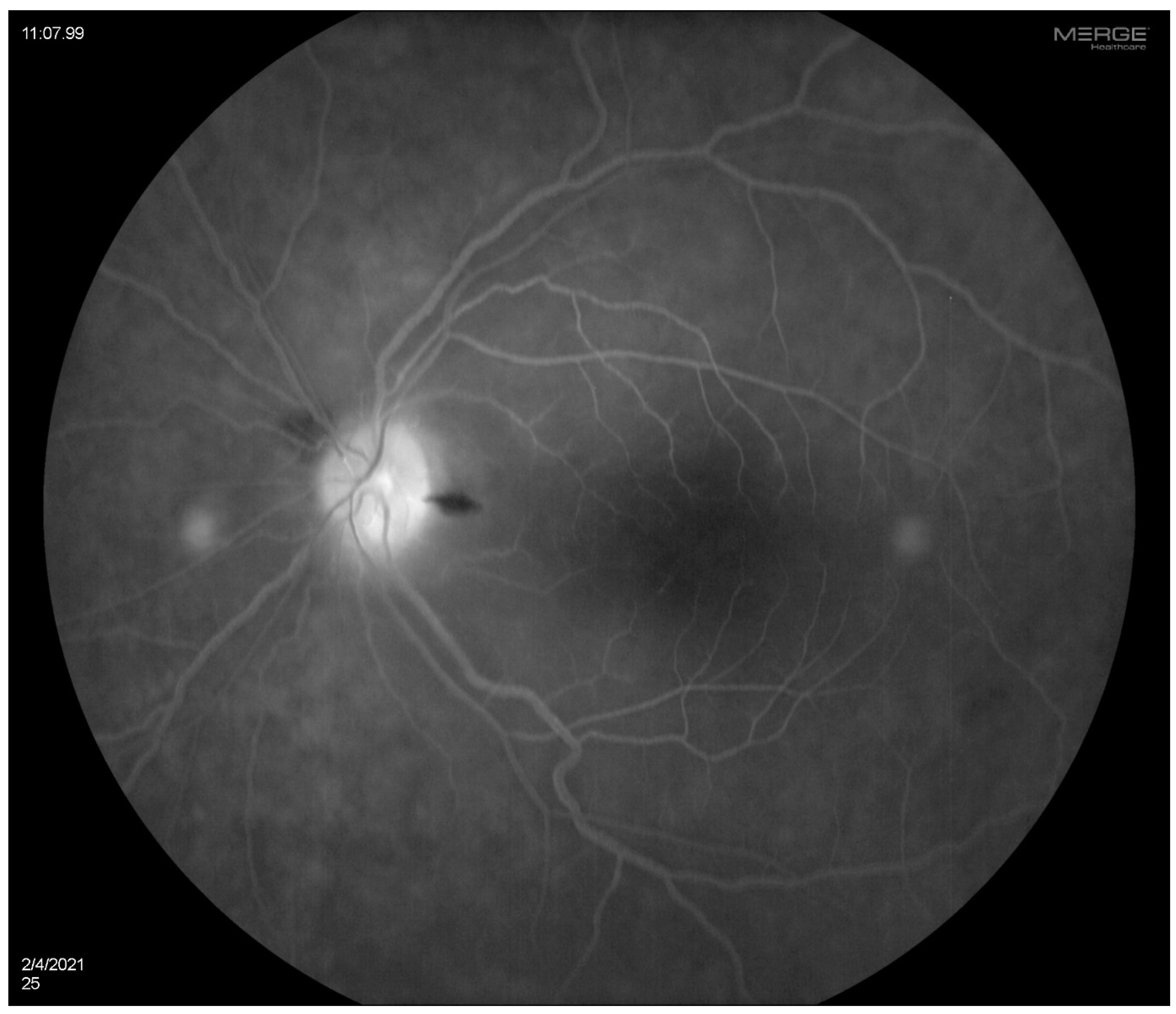 Diagnostics 14 01329 g002