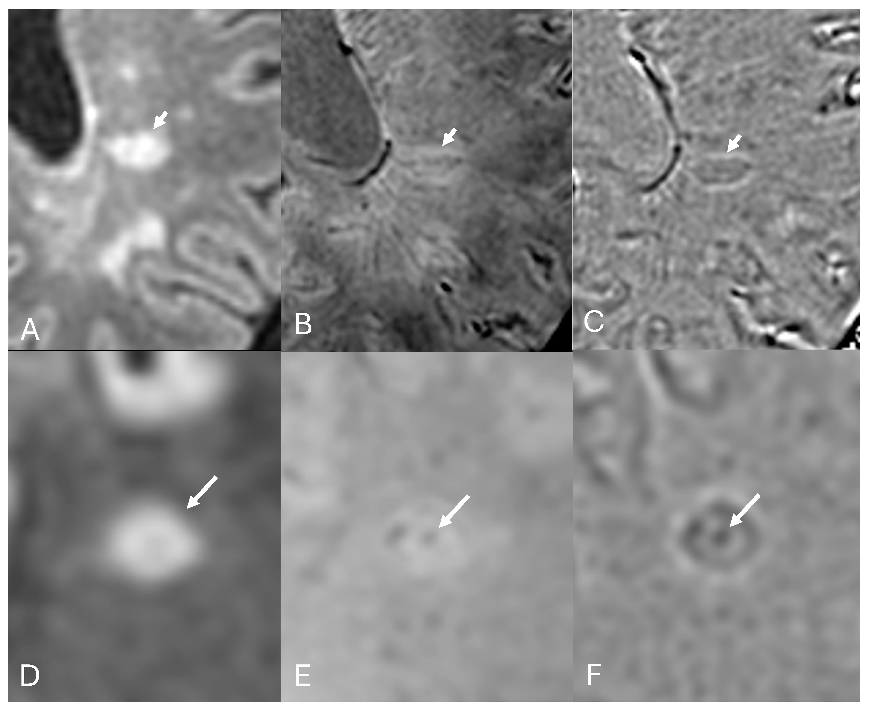 Diagnostics 14 01362 g005 Diagnostics 14 01362 g005