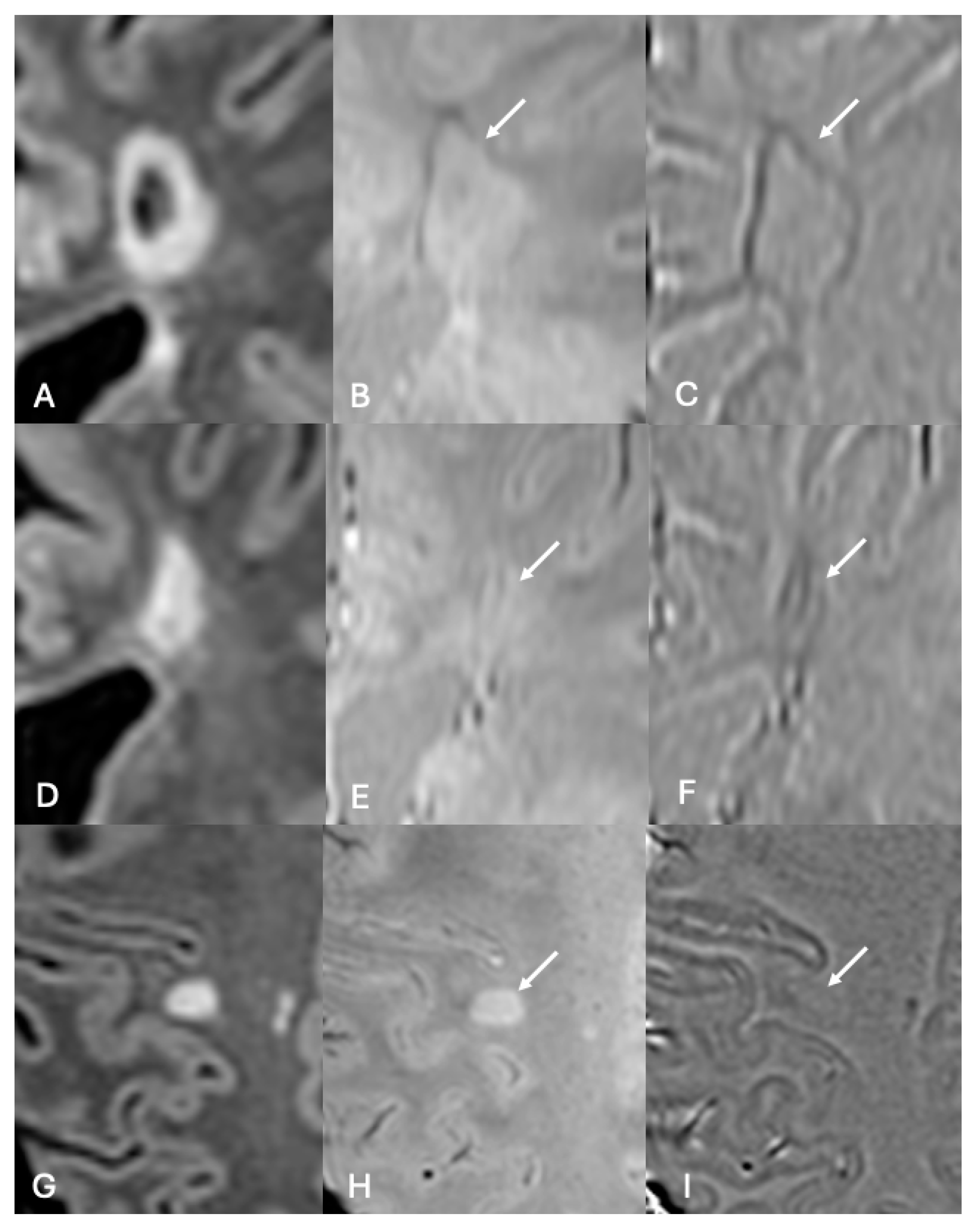 Diagnostics 14 01362 g006 Diagnostics 14 01362 g006