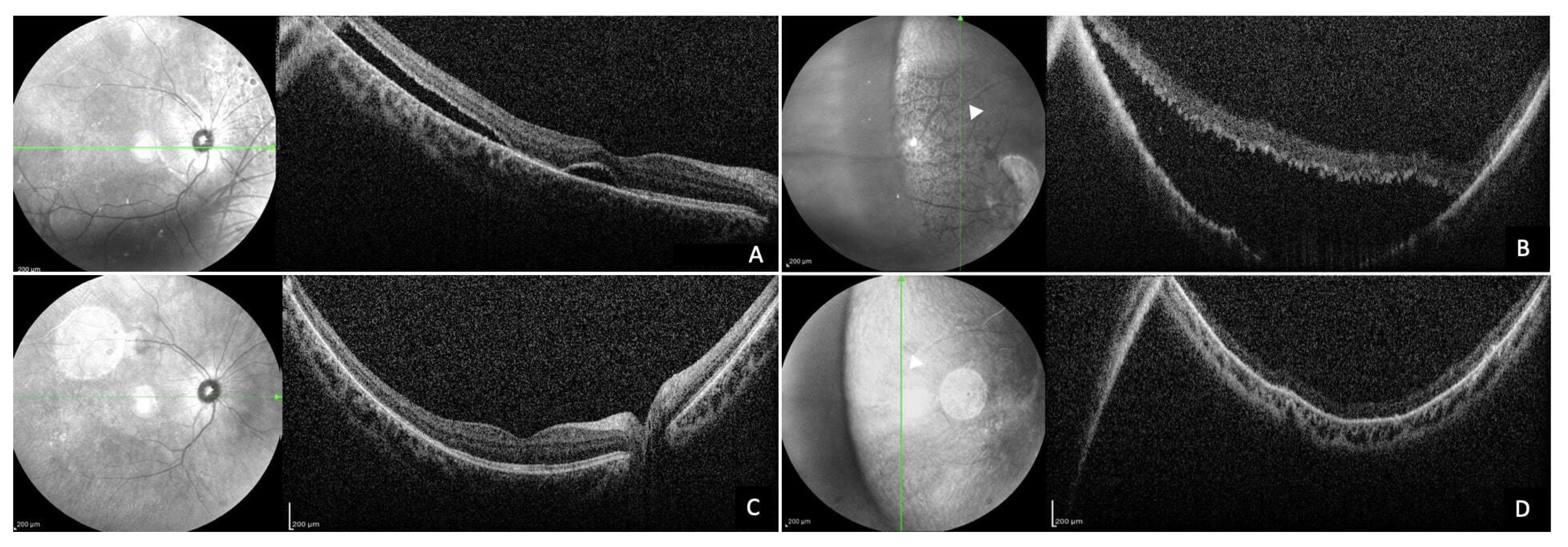 Diagnostics 14 01385 g003
