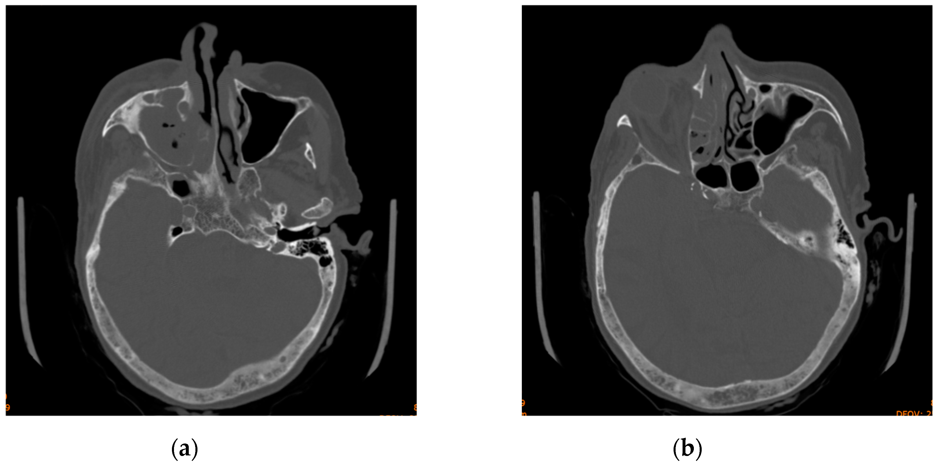 Diagnostics 14 01391 g002 Diagnostics 14 01391 g002
