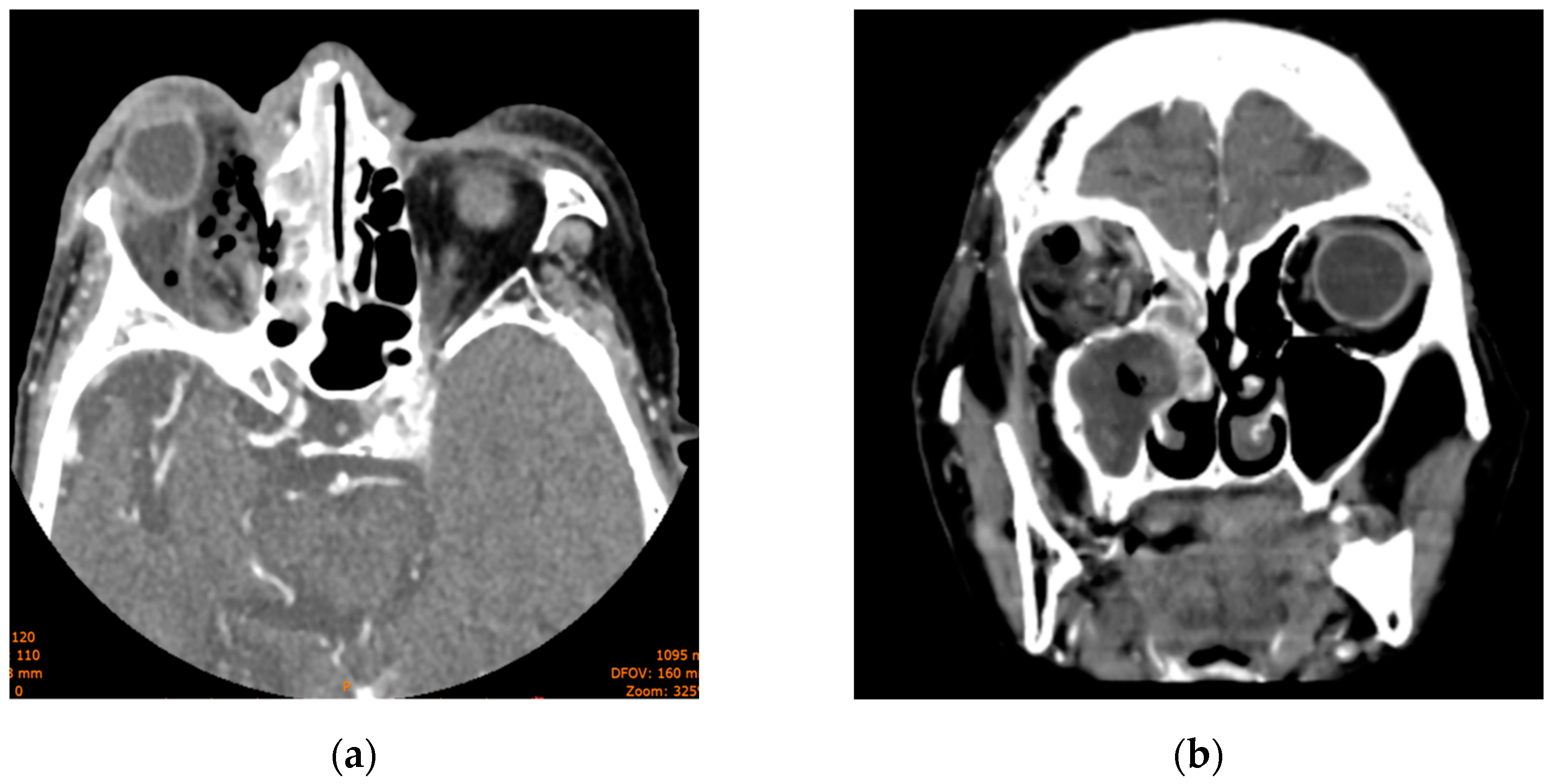 Diagnostics 14 01391 g003 Diagnostics 14 01391 g003