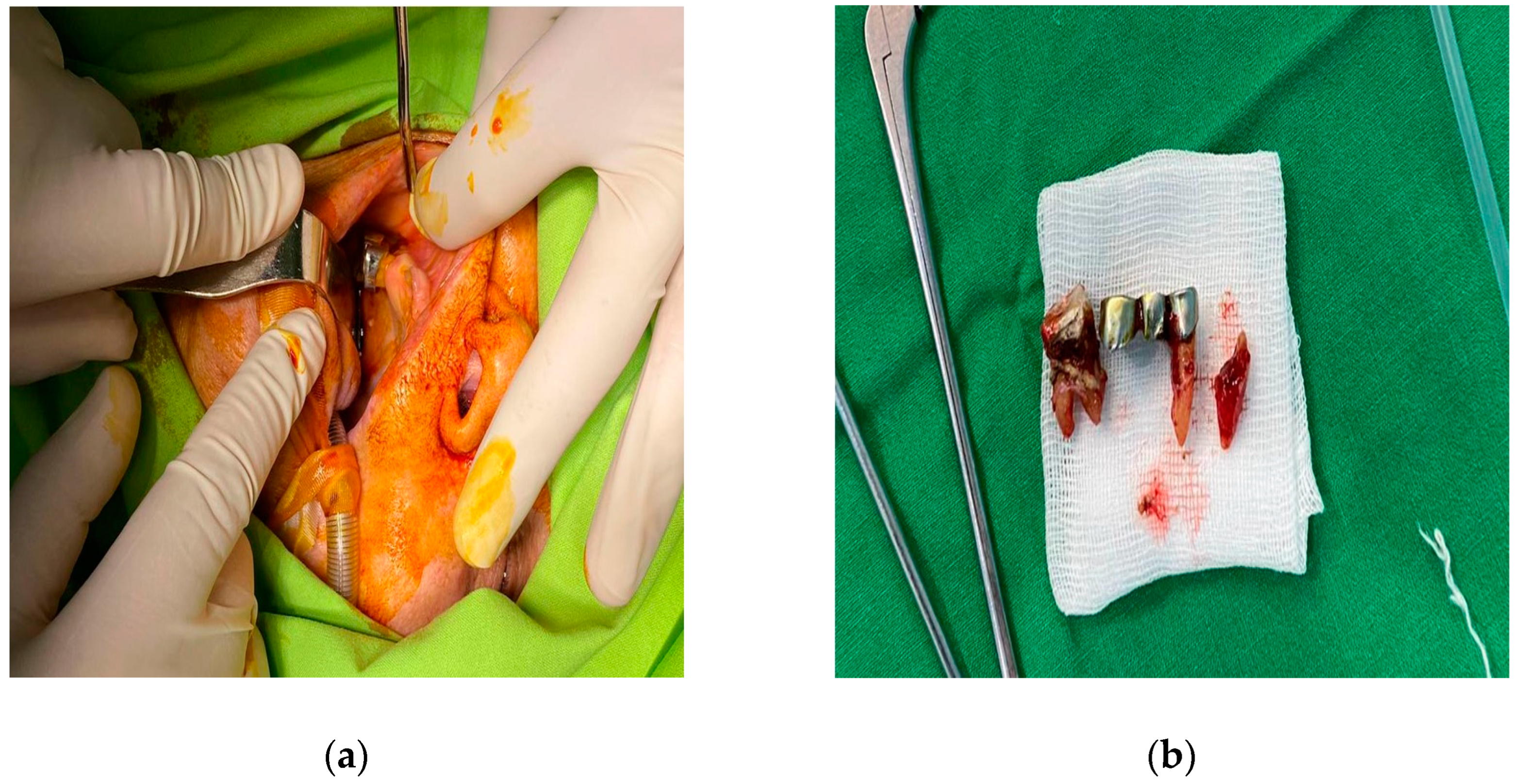 Diagnostics 14 01391 g004 Diagnostics 14 01391 g004