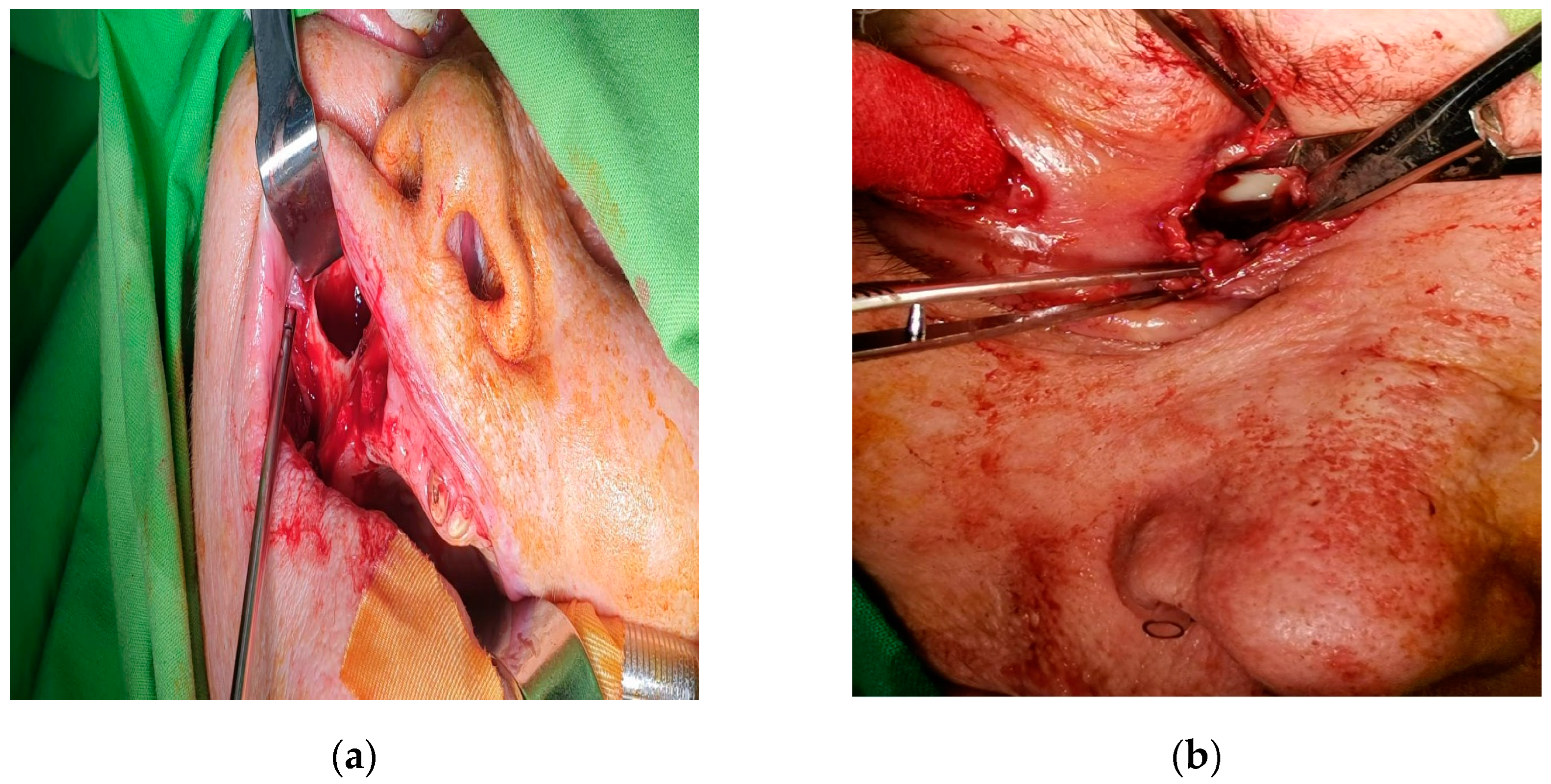 Diagnostics 14 01391 g005 Diagnostics 14 01391 g005