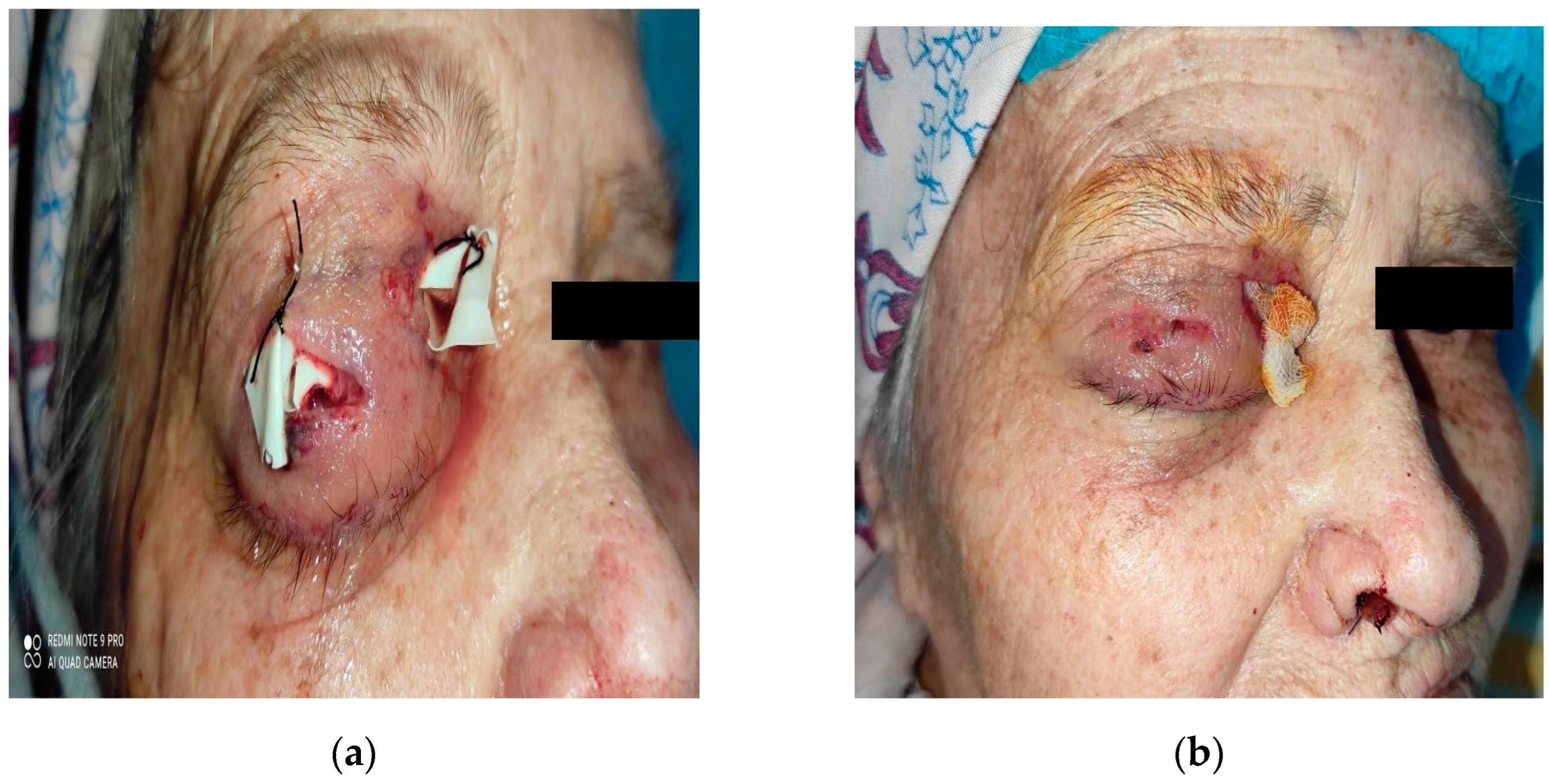 Diagnostics 14 01391 g007 Diagnostics 14 01391 g007