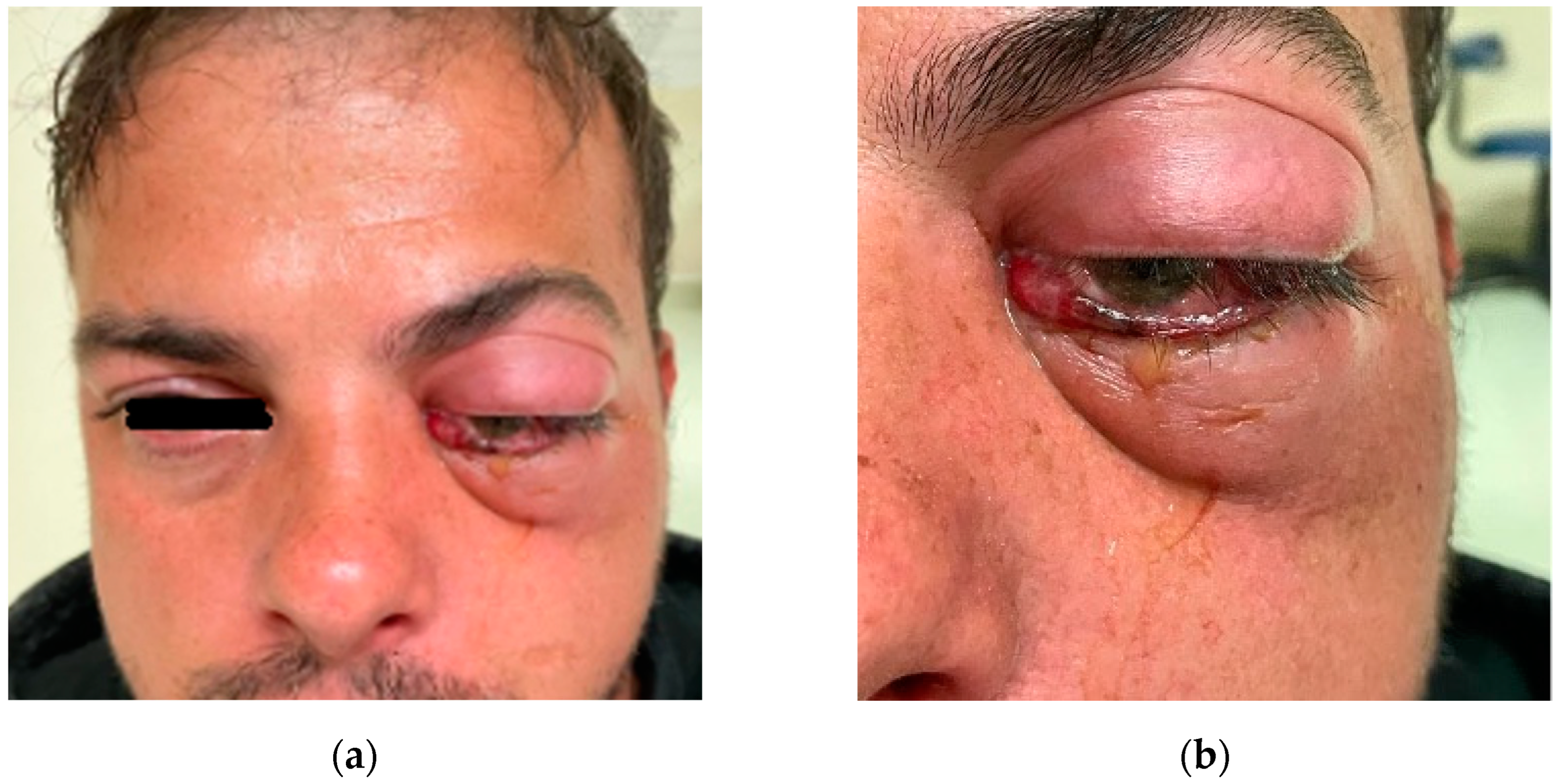 Diagnostics 14 01391 g009 Diagnostics 14 01391 g009