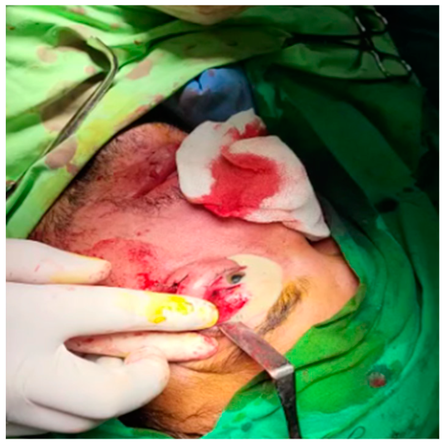 Diagnostics 14 01391 g011 Diagnostics 14 01391 g011