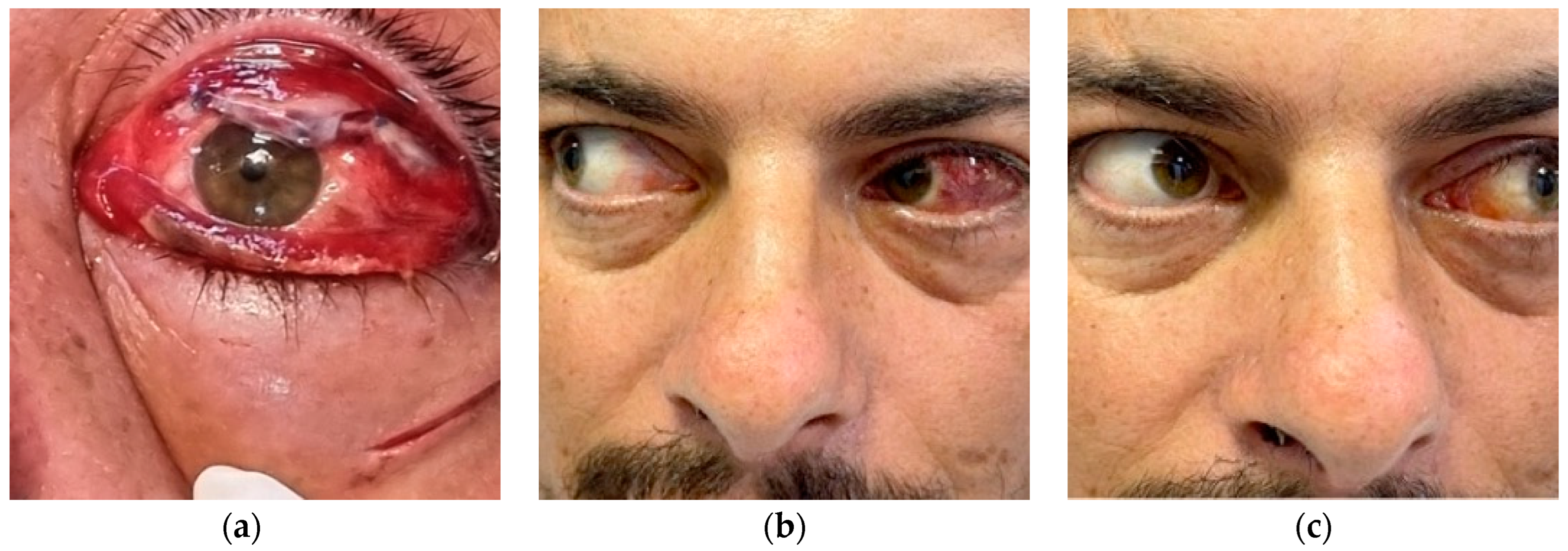 Diagnostics 14 01391 g012 Diagnostics 14 01391 g012