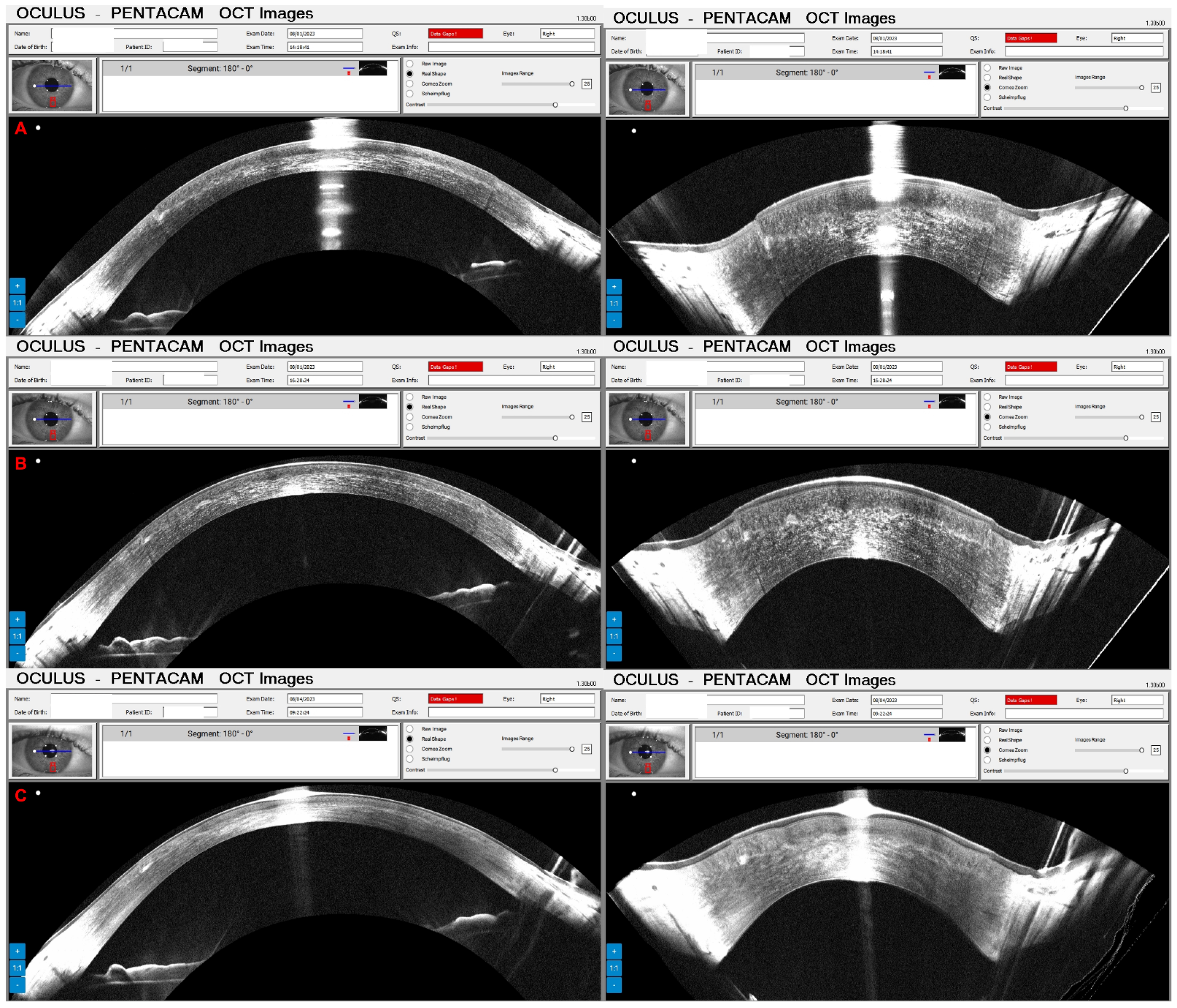Diagnostics 14 01455 g012
