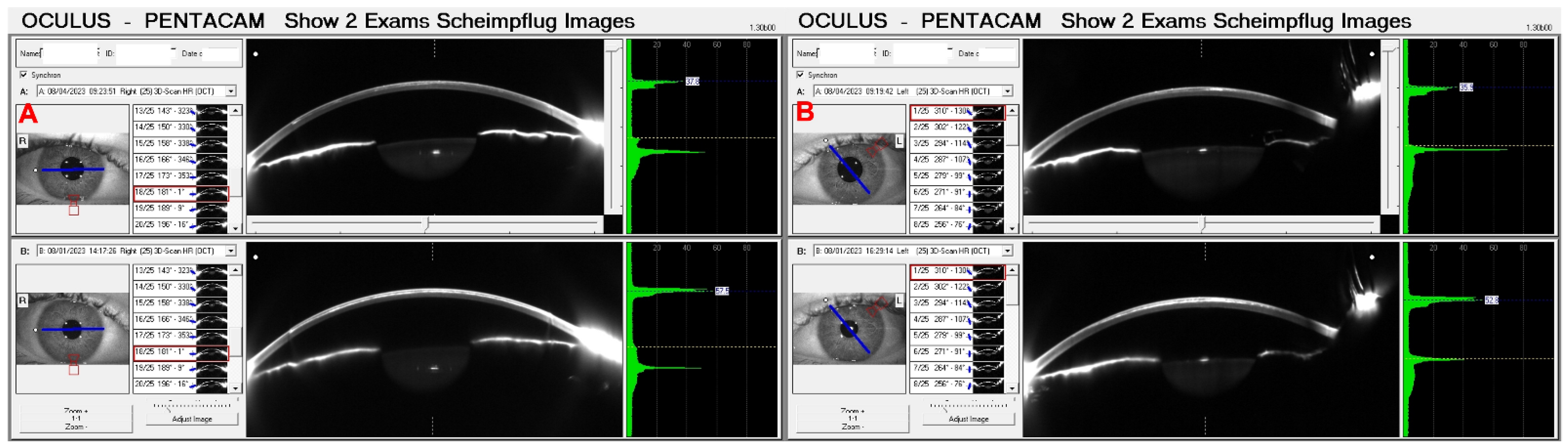 Diagnostics 14 01455 g014