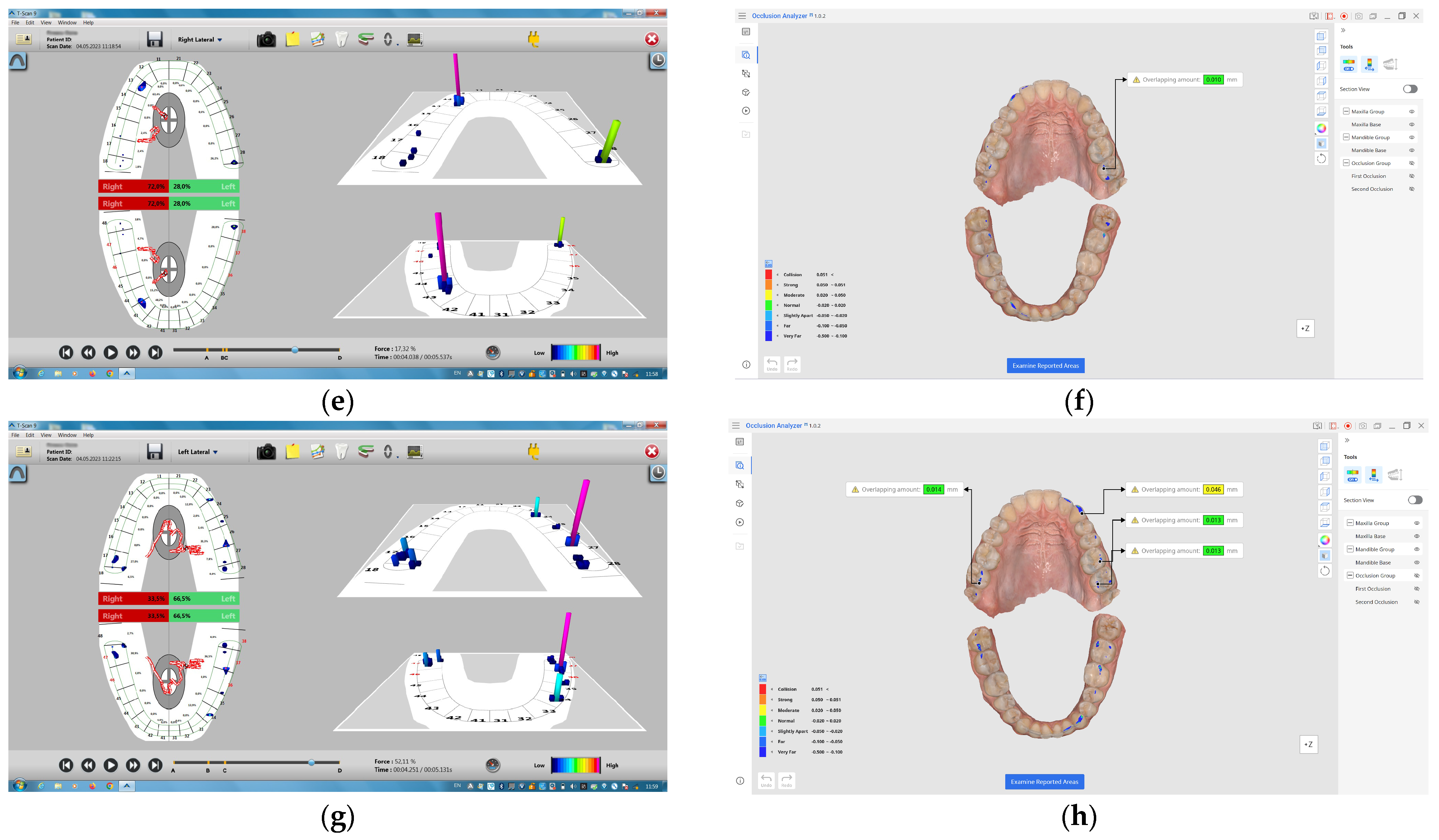 Diagnostics 14 01457 g002b