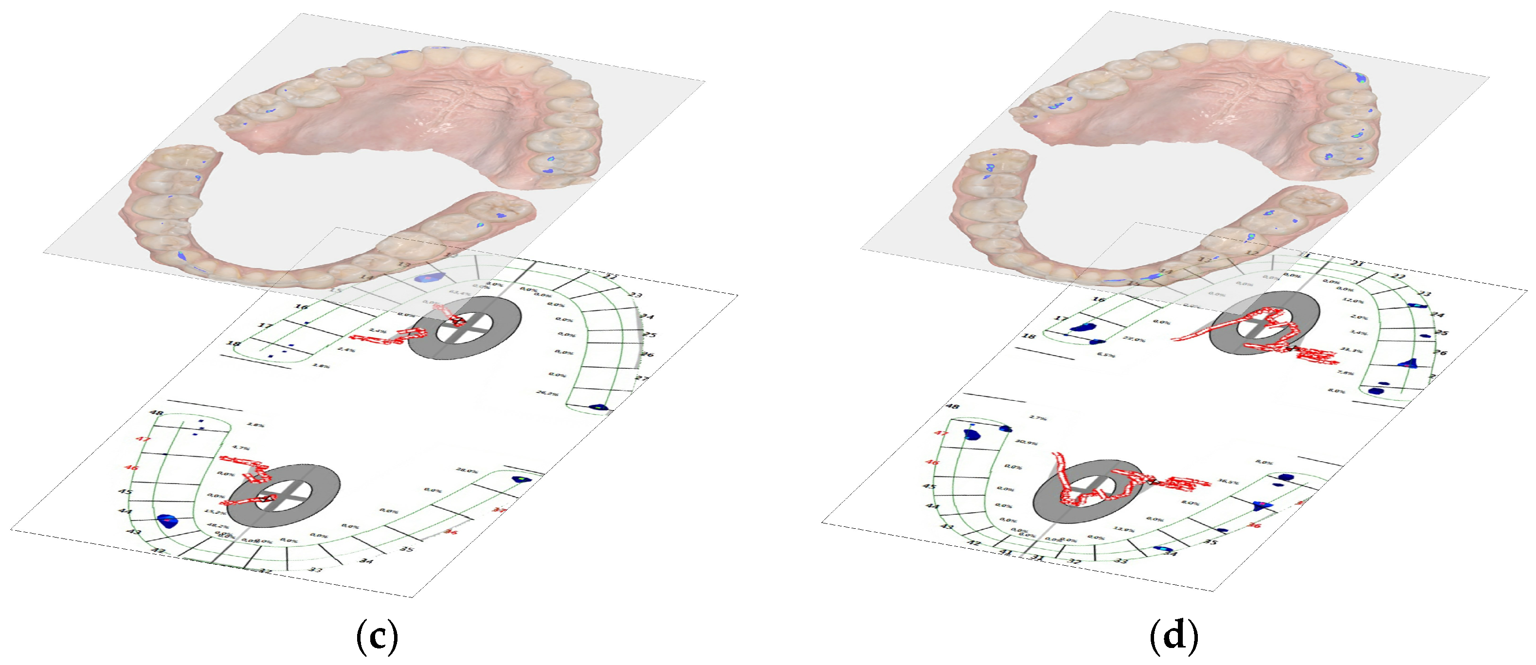 Diagnostics 14 01457 g007b