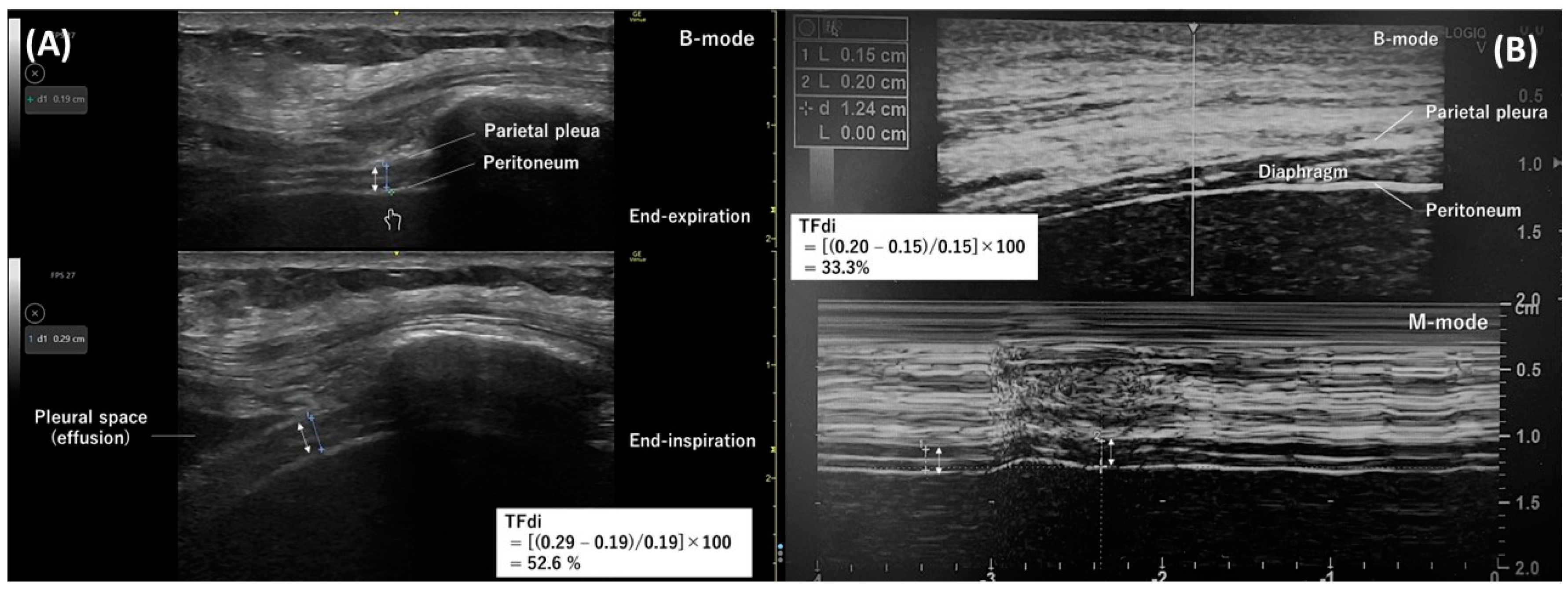 Diagnostics 14 01481 g001