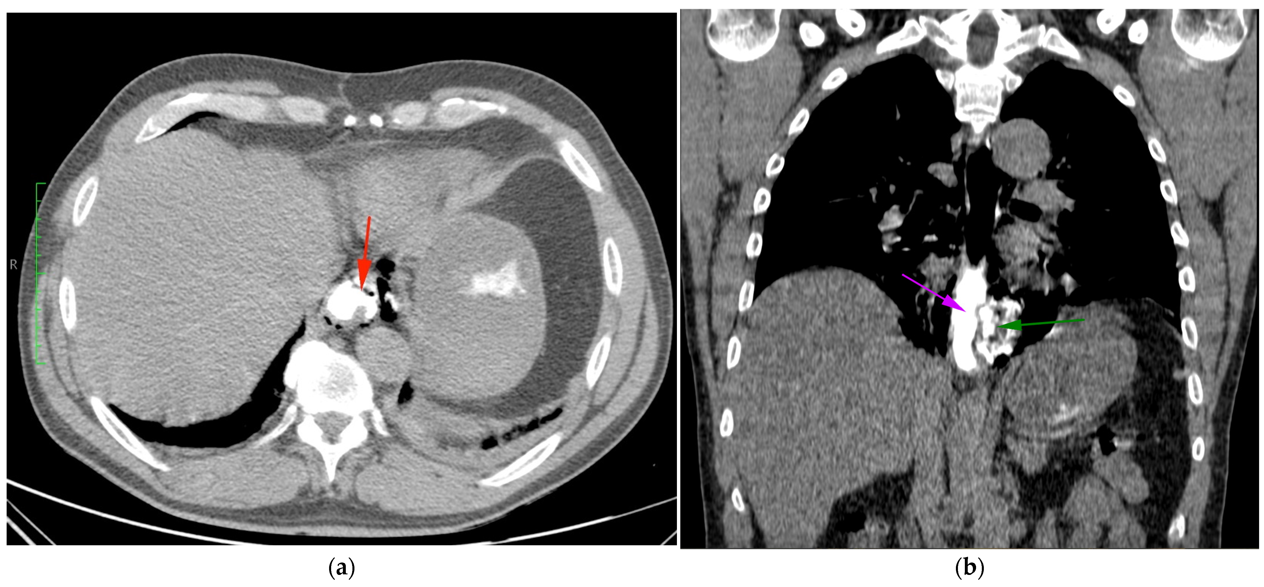 Diagnostics 14 01592 g002 Diagnostics 14 01592 g002