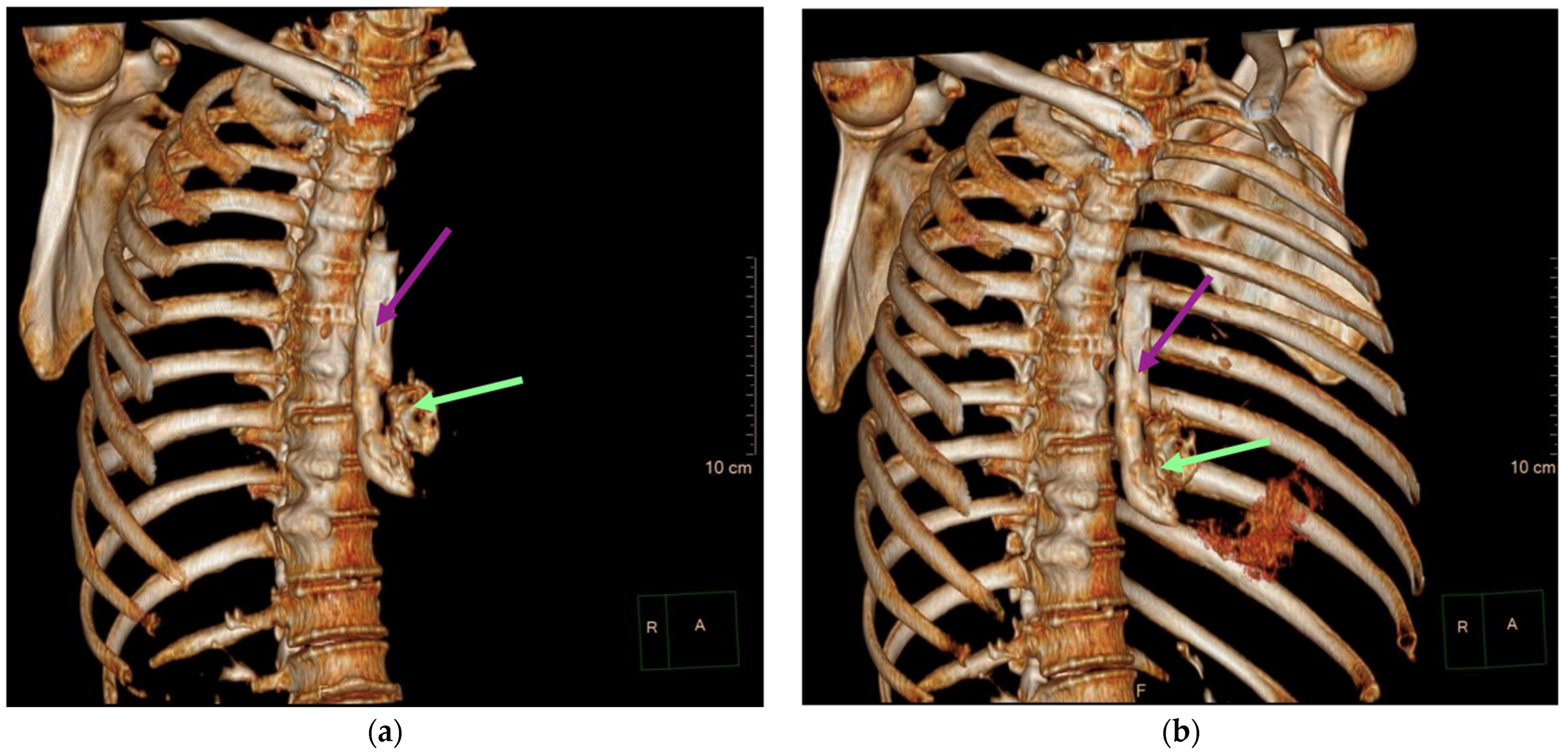 Diagnostics 14 01592 g003 Diagnostics 14 01592 g003
