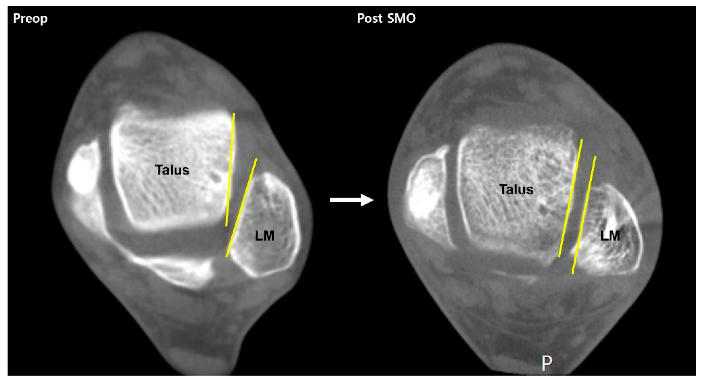 Diagnostics 14 01641 g005