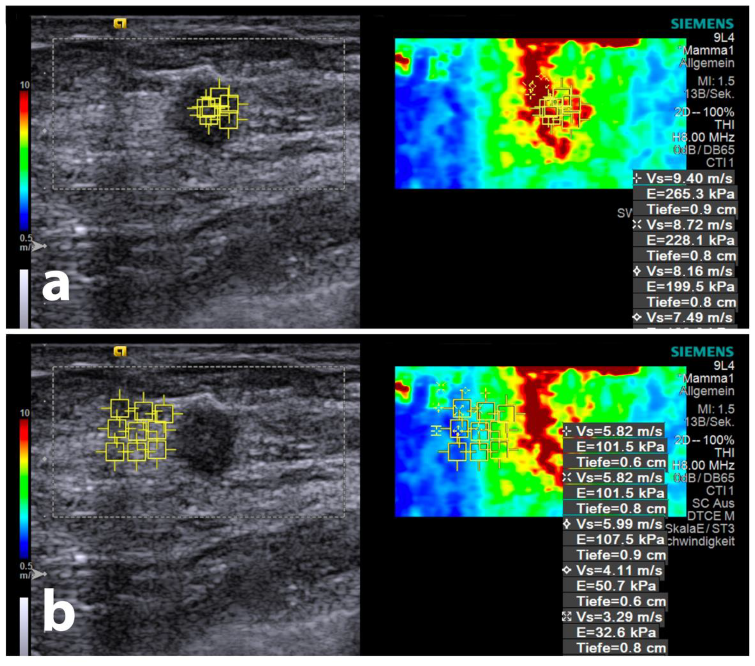 Diagnostics 14 01657 g003