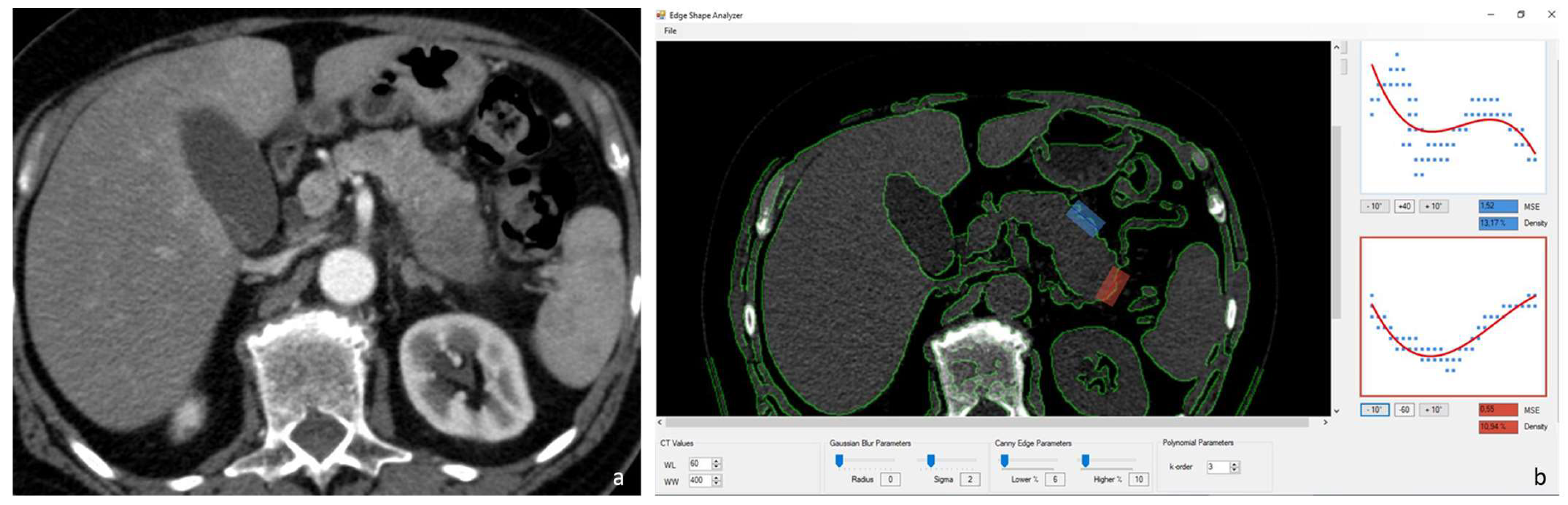 Diagnostics 14 01681 g001