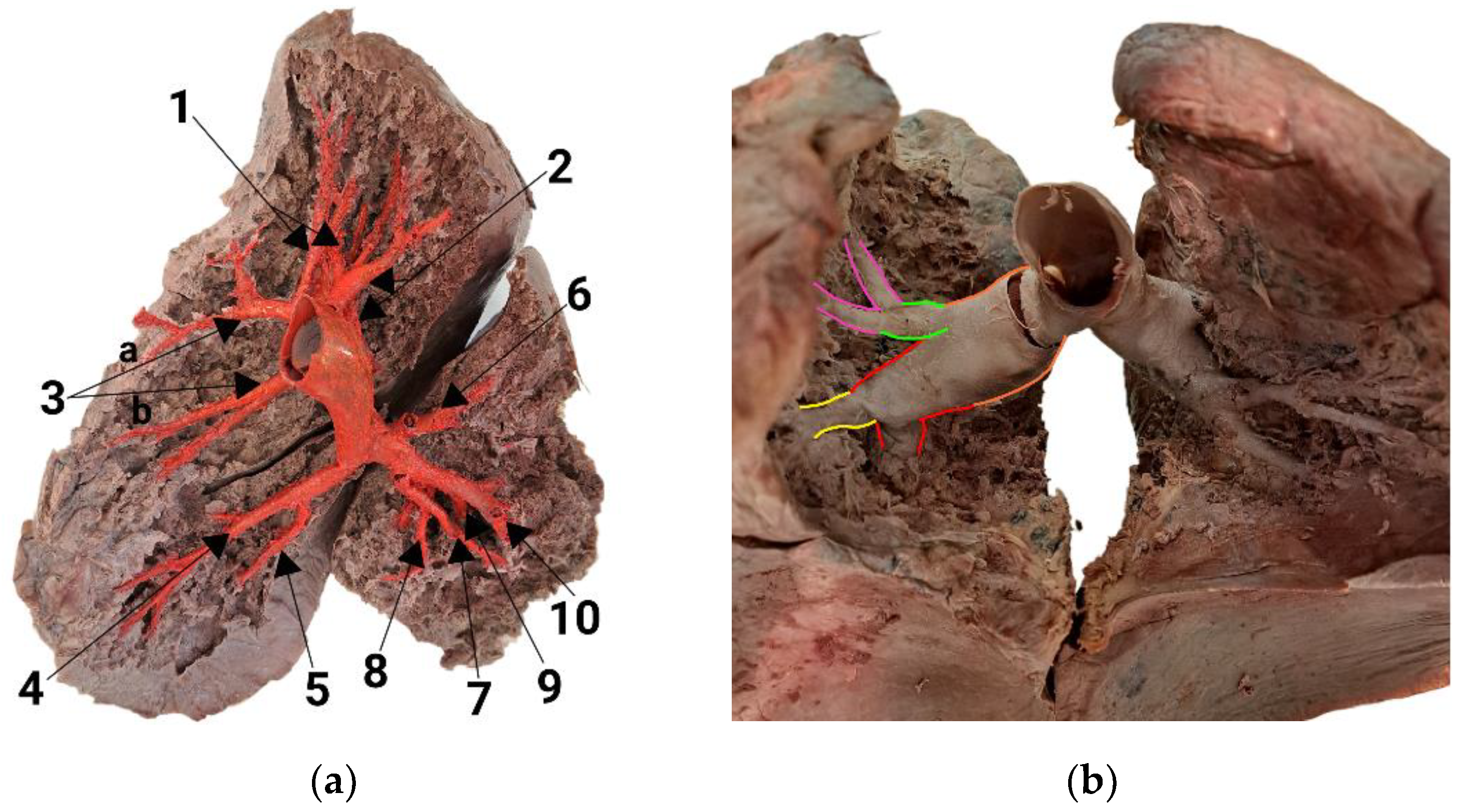 Diagnostics 14 01684 g002 Diagnostics 14 01684 g002